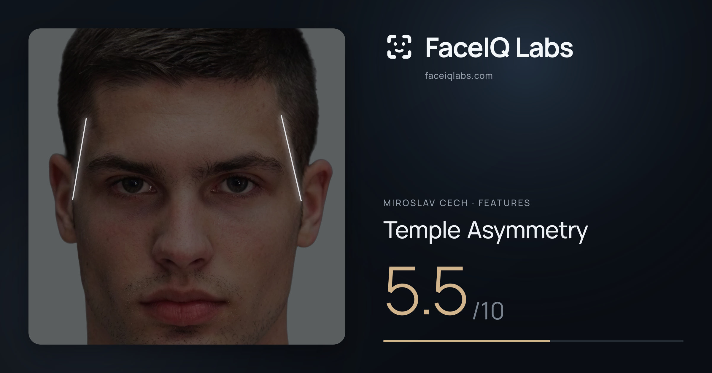 Miroslav Cech Temple Asymmetry: 5.5/10, drawn on the photo