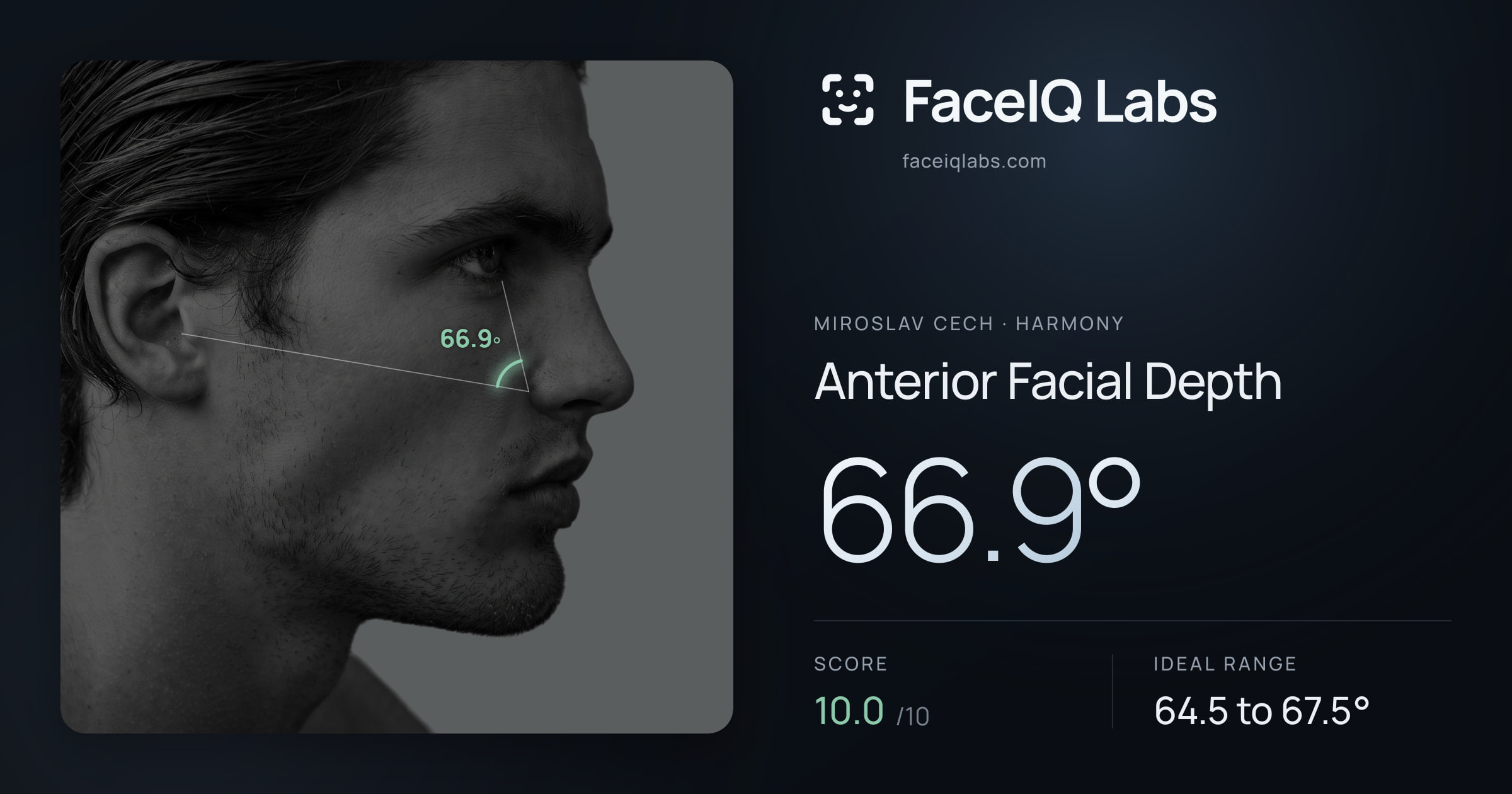 Miroslav Cech Anterior Facial Depth: 66.9°, drawn on the photo