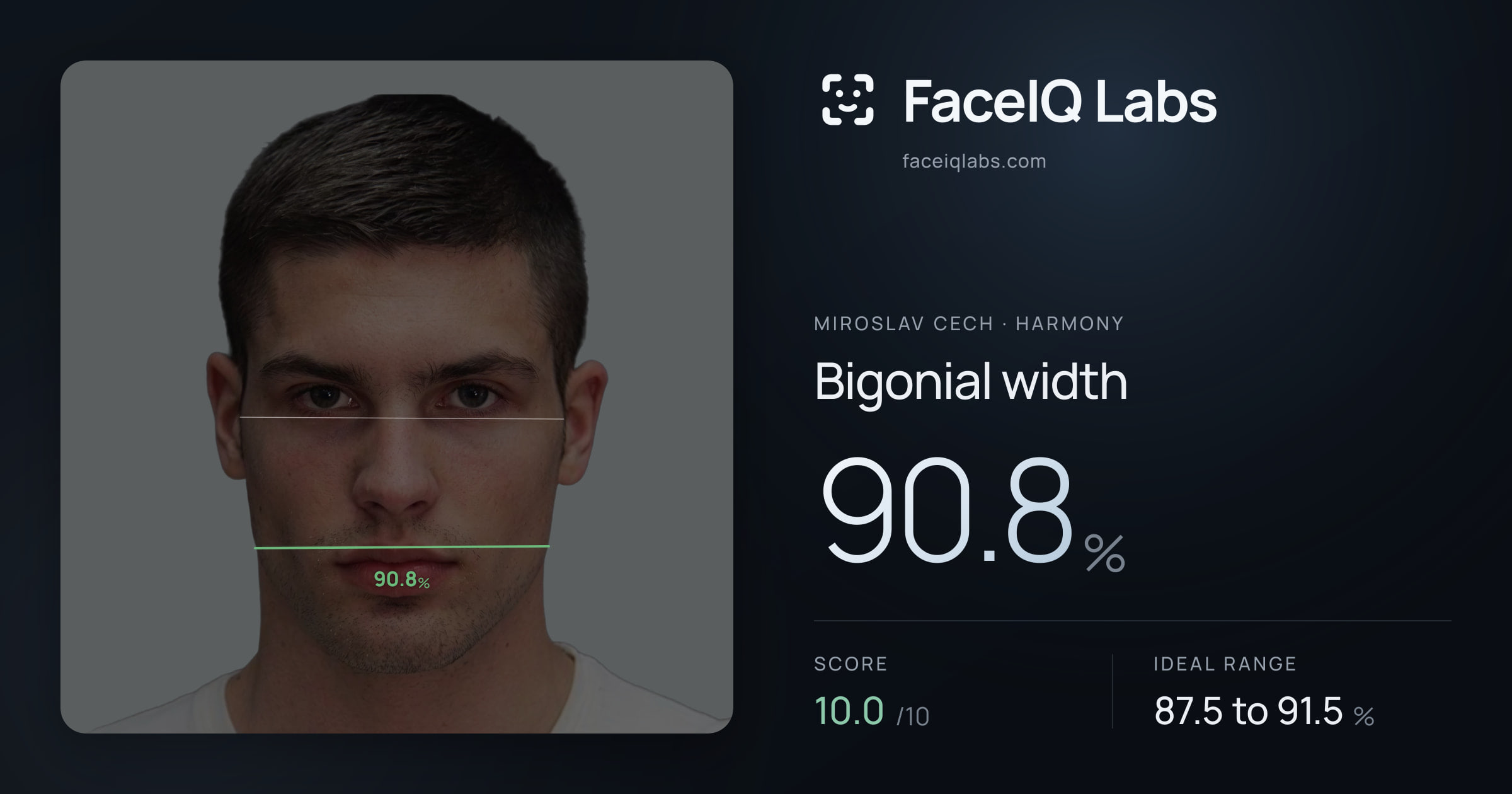 Miroslav Cech Bigonial width: 90.8%, drawn on the photo