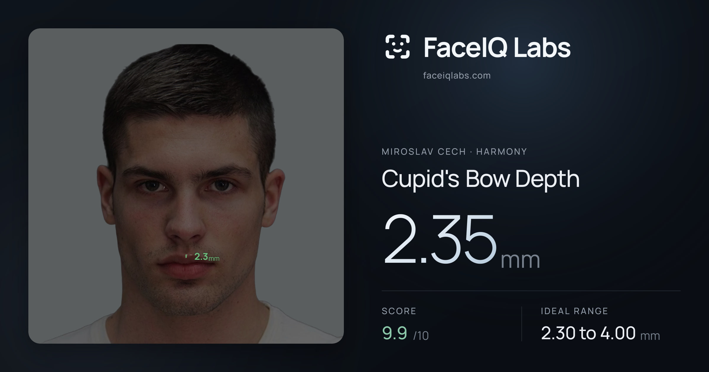 Miroslav Cech Cupid's Bow Depth: 2.35mm, drawn on the photo