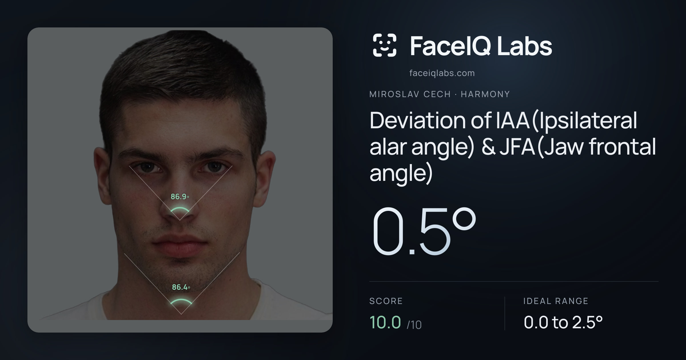 Miroslav Cech Deviation of IAA(Ipsilateral alar angle) & JFA(Jaw frontal angle): 0.5°, drawn on the photo