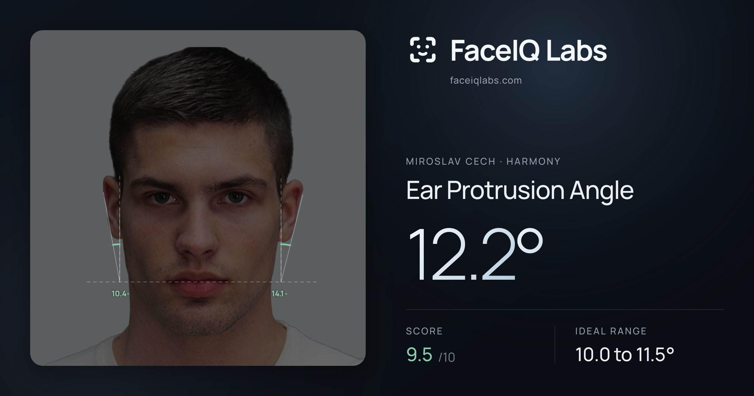 Miroslav Cech Ear Protrusion Angle: 12.2°, drawn on the photo