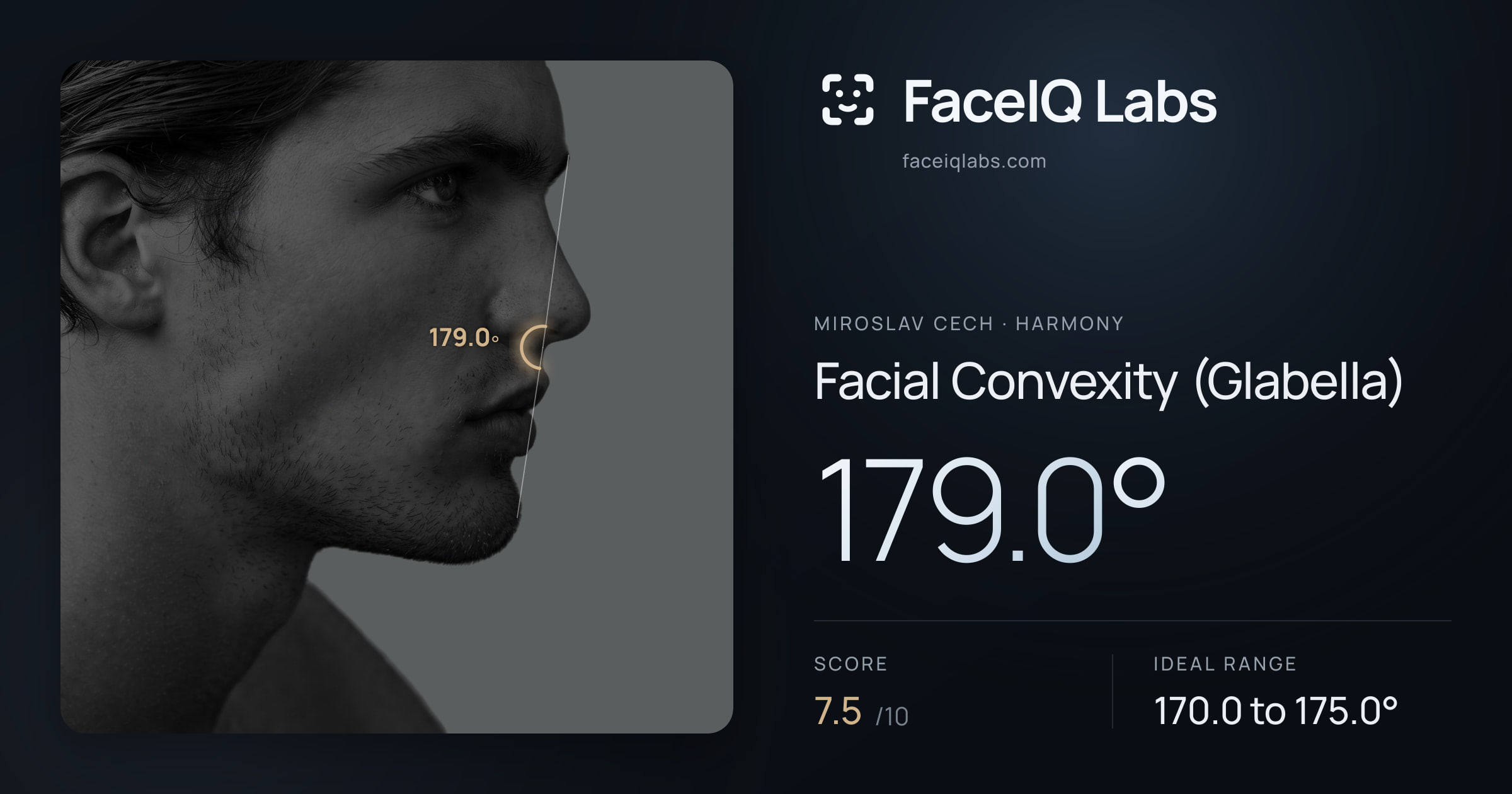 Miroslav Cech Facial Convexity (Glabella): 179.0°, drawn on the photo