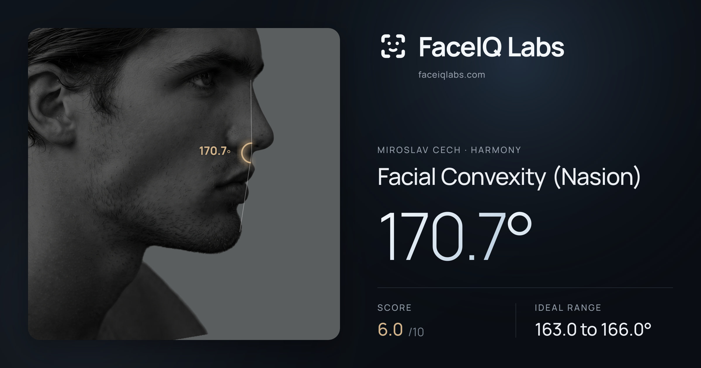 Miroslav Cech Facial Convexity (Nasion): 170.7°, drawn on the photo