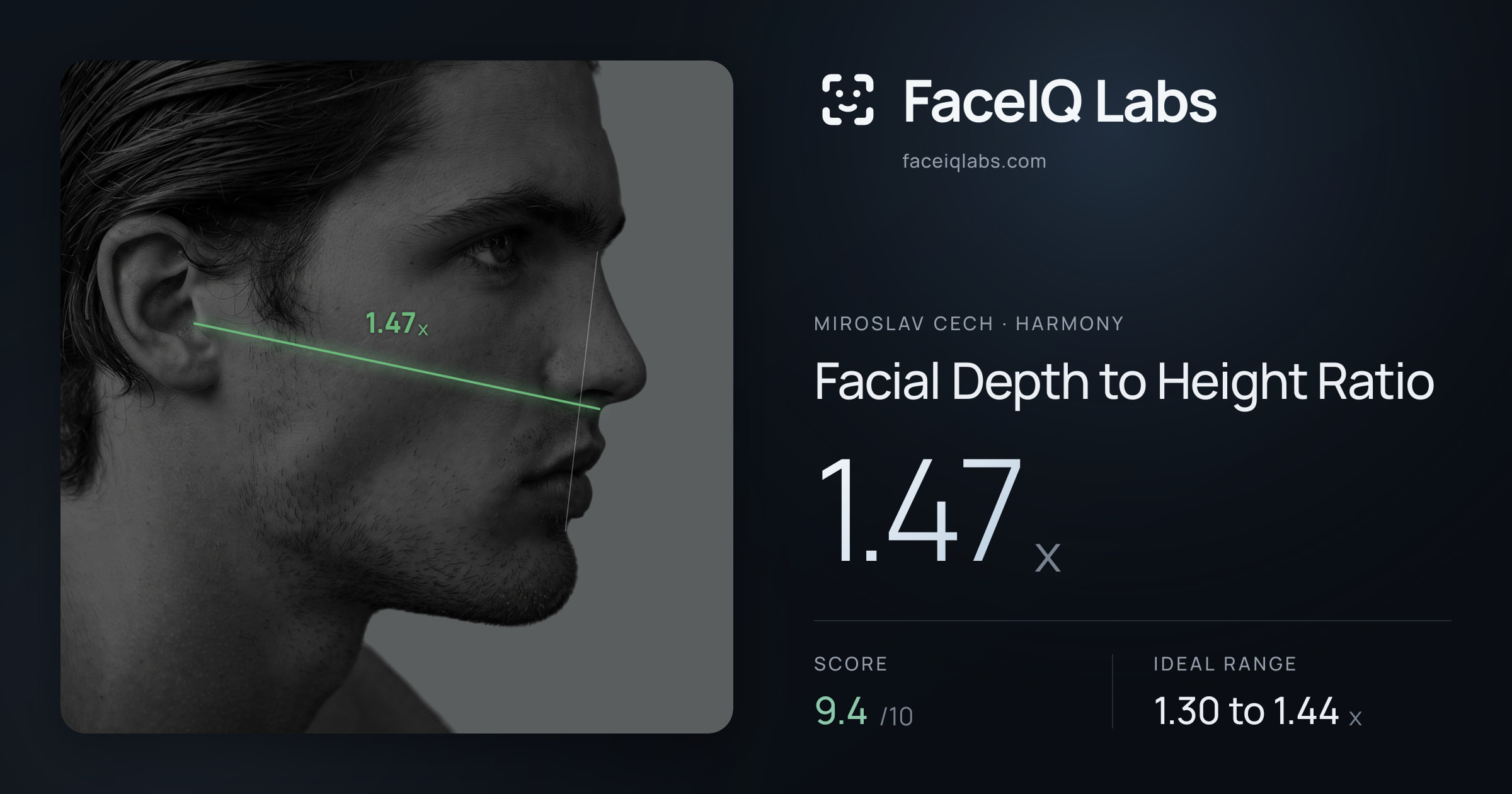 Miroslav Cech Facial Depth to Height Ratio: 1.47x, drawn on the photo