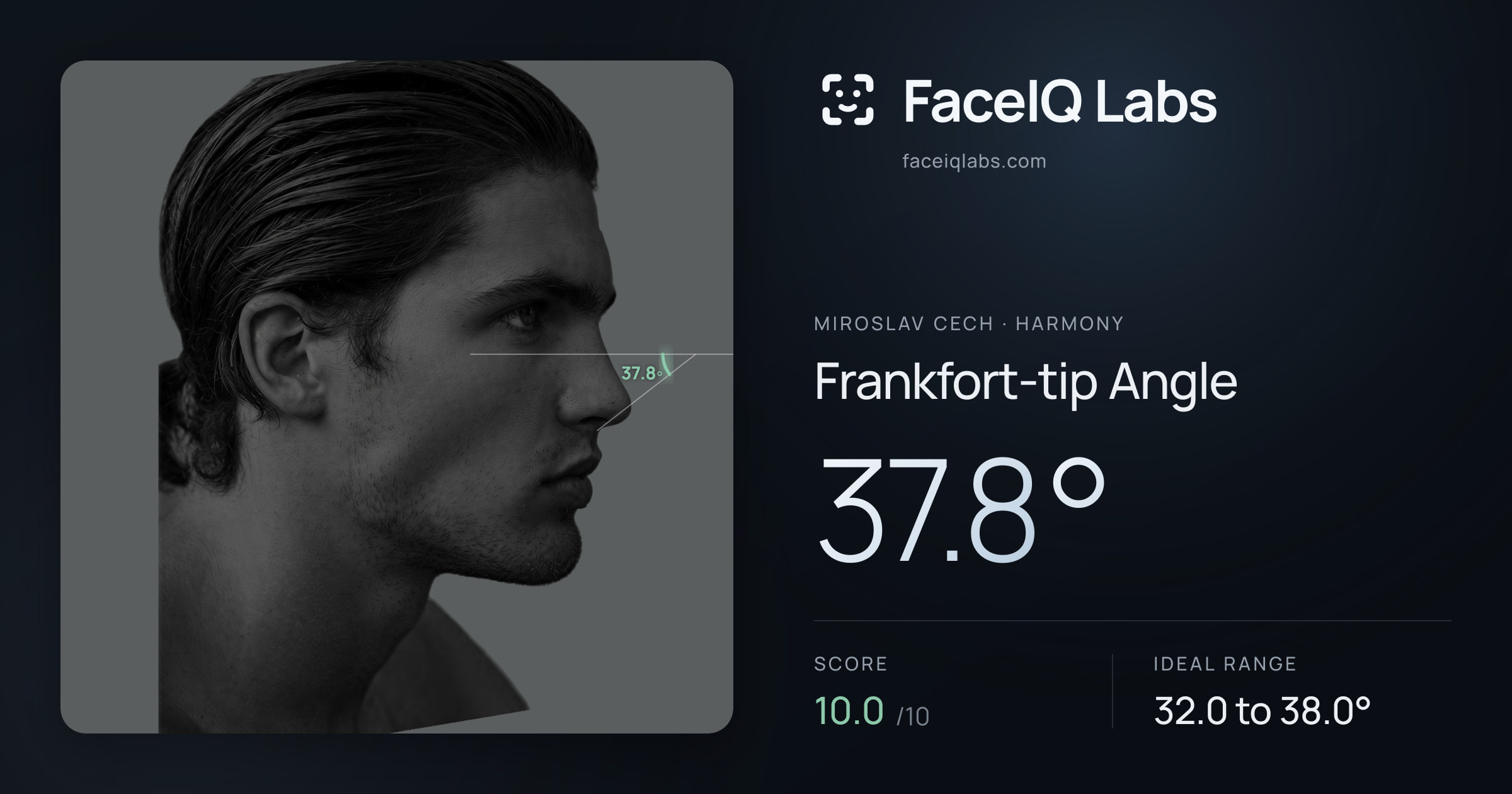 Miroslav Cech Frankfort-tip Angle: 37.8°, drawn on the photo