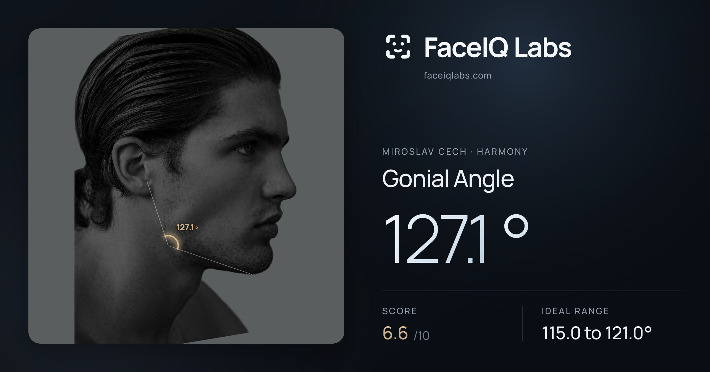 Miroslav Cech Gonial Angle: 127.1°, drawn on the photo