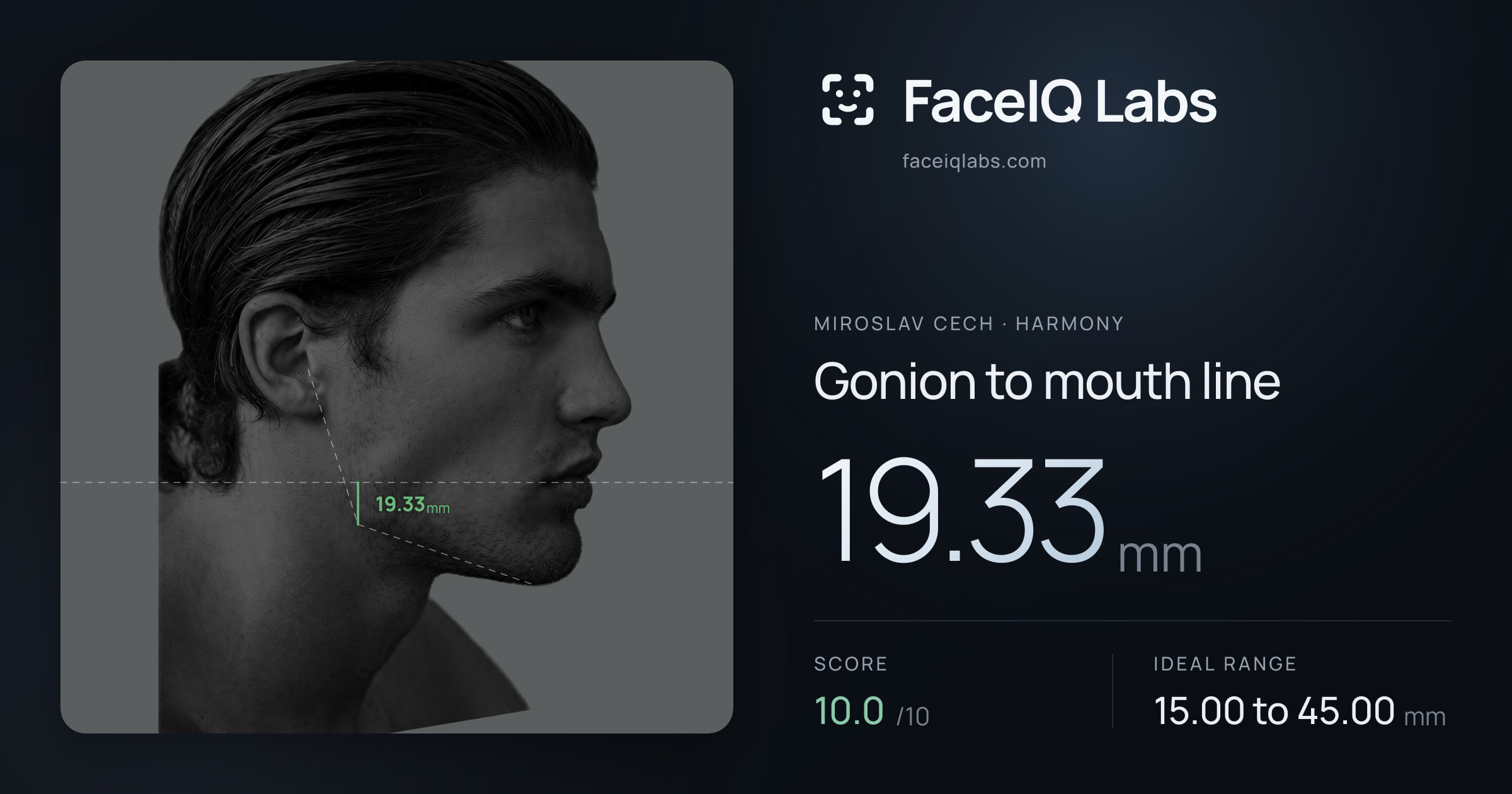 Miroslav Cech Gonion to mouth line: 19.33mm, drawn on the photo