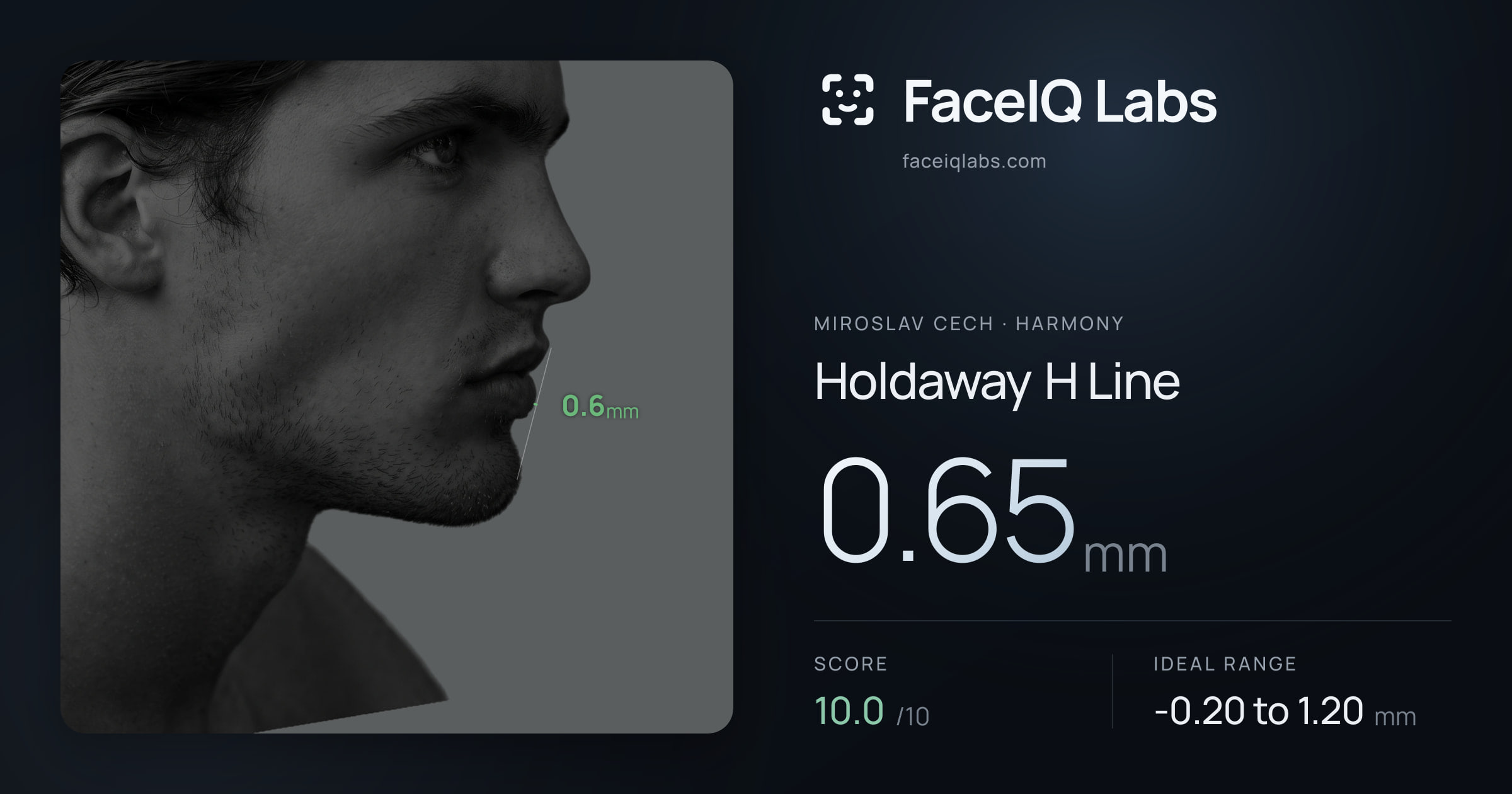 Miroslav Cech Holdaway H Line: 0.65mm, drawn on the photo