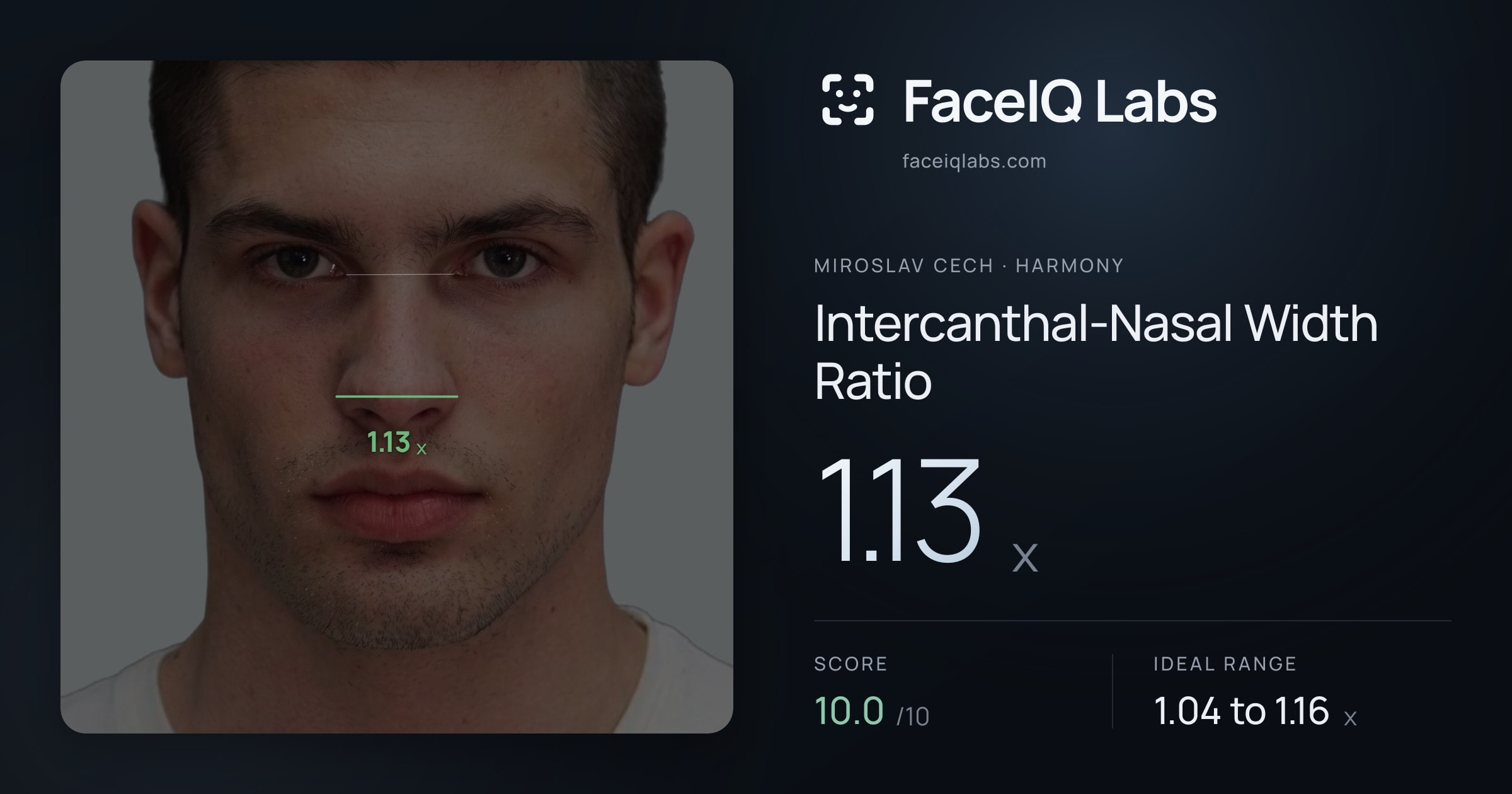 Miroslav Cech Intercanthal-Nasal Width Ratio: 1.13x, drawn on the photo