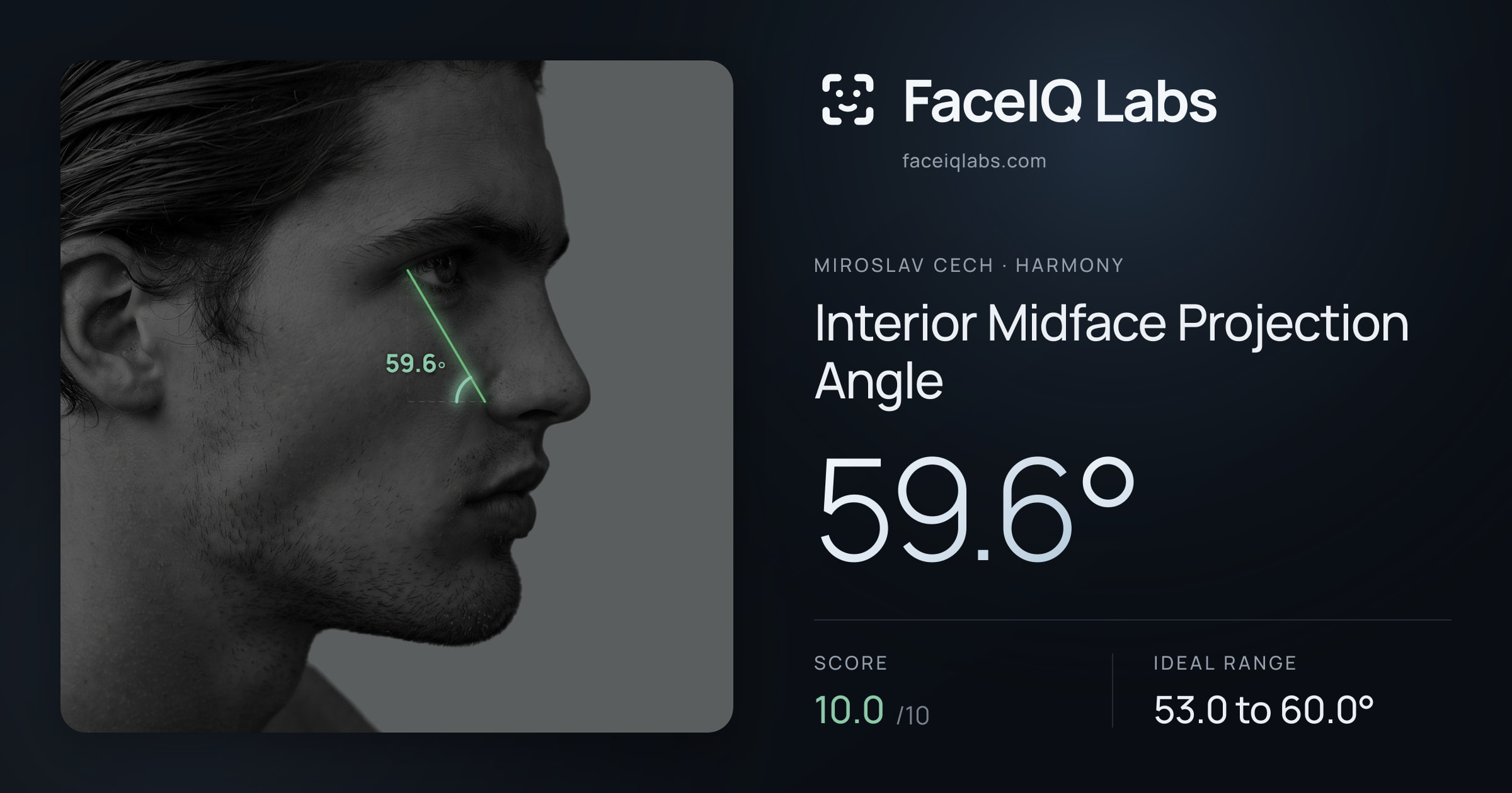 Miroslav Cech Interior Midface Projection Angle: 59.6°, drawn on the photo
