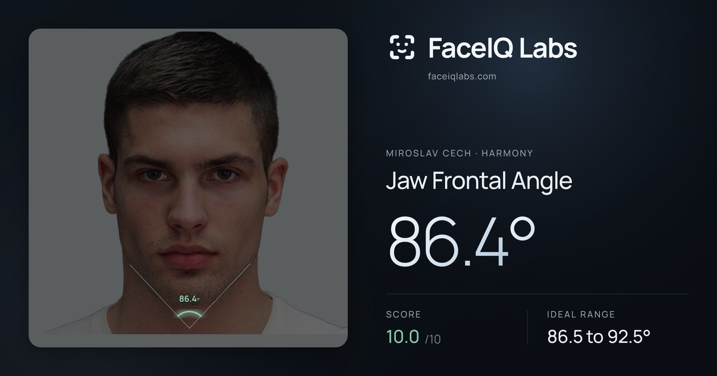 Miroslav Cech Jaw Frontal Angle: 86.4°, drawn on the photo