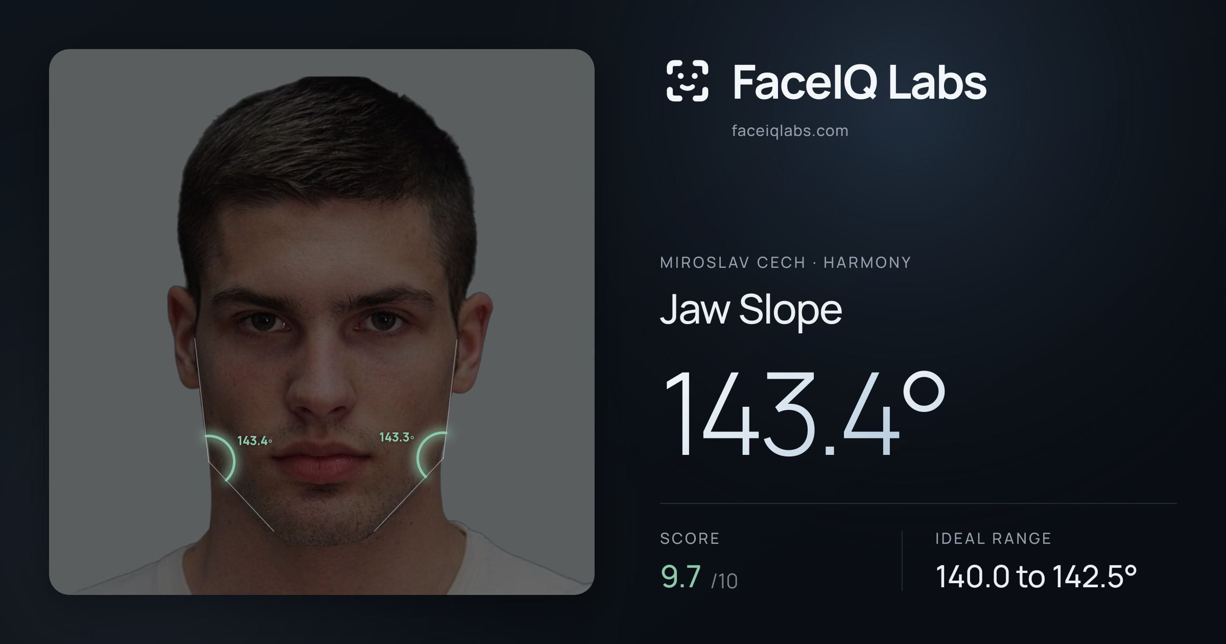 Miroslav Cech Jaw Slope: 143.4°, drawn on the photo