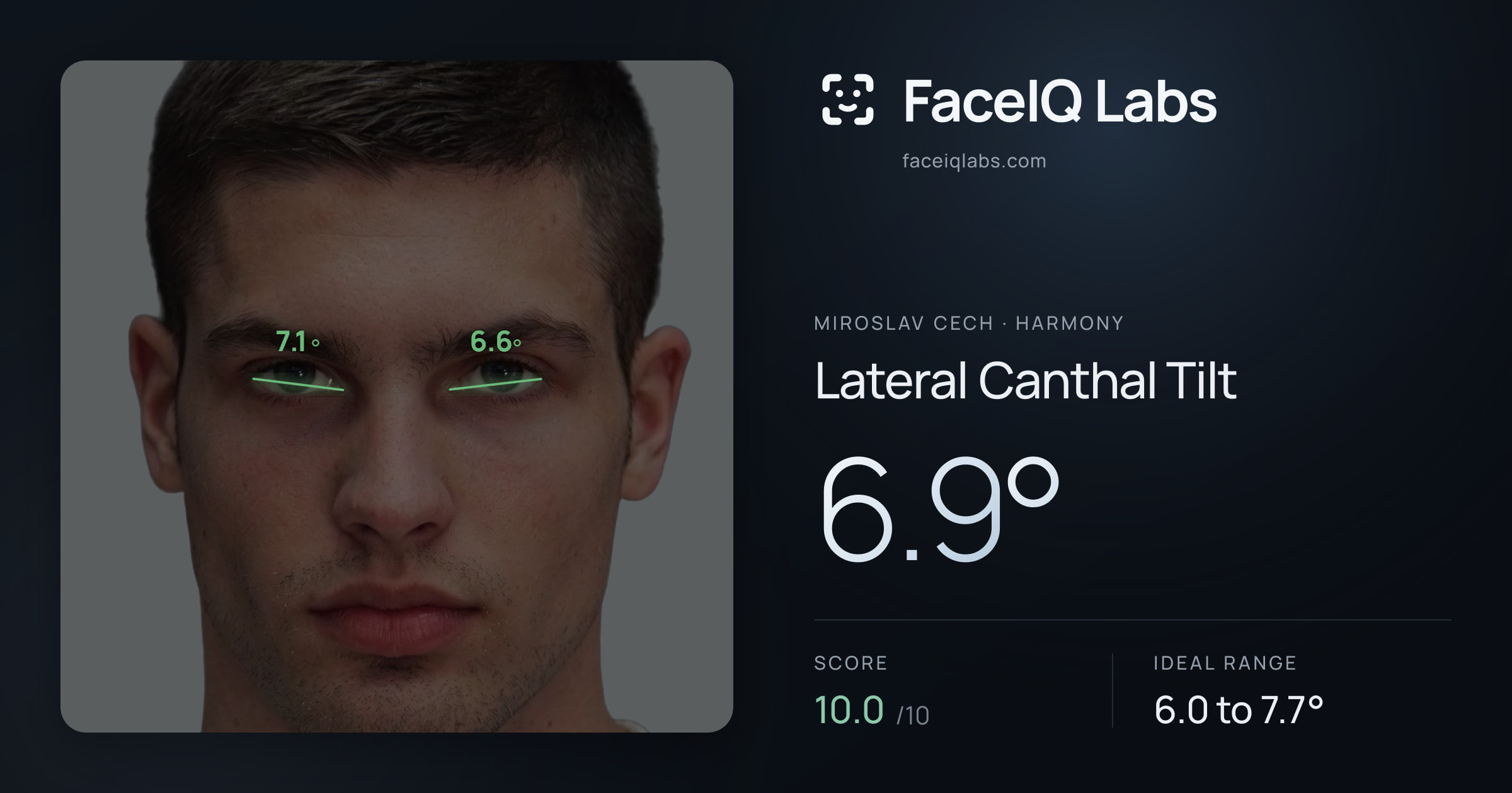 Miroslav Cech Lateral Canthal Tilt: 6.9°, drawn on the photo