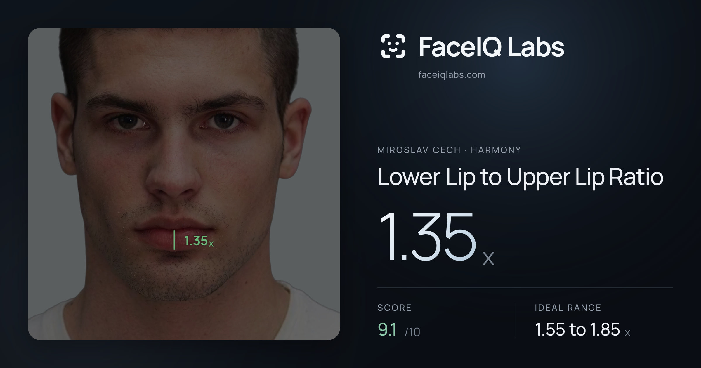 Miroslav Cech Lower Lip to Upper Lip Ratio: 1.35x, drawn on the photo