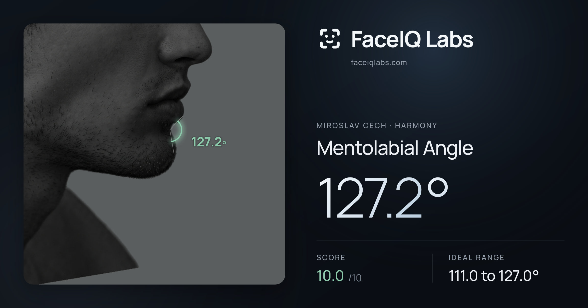 Miroslav Cech Mentolabial Angle: 127.2°, drawn on the photo