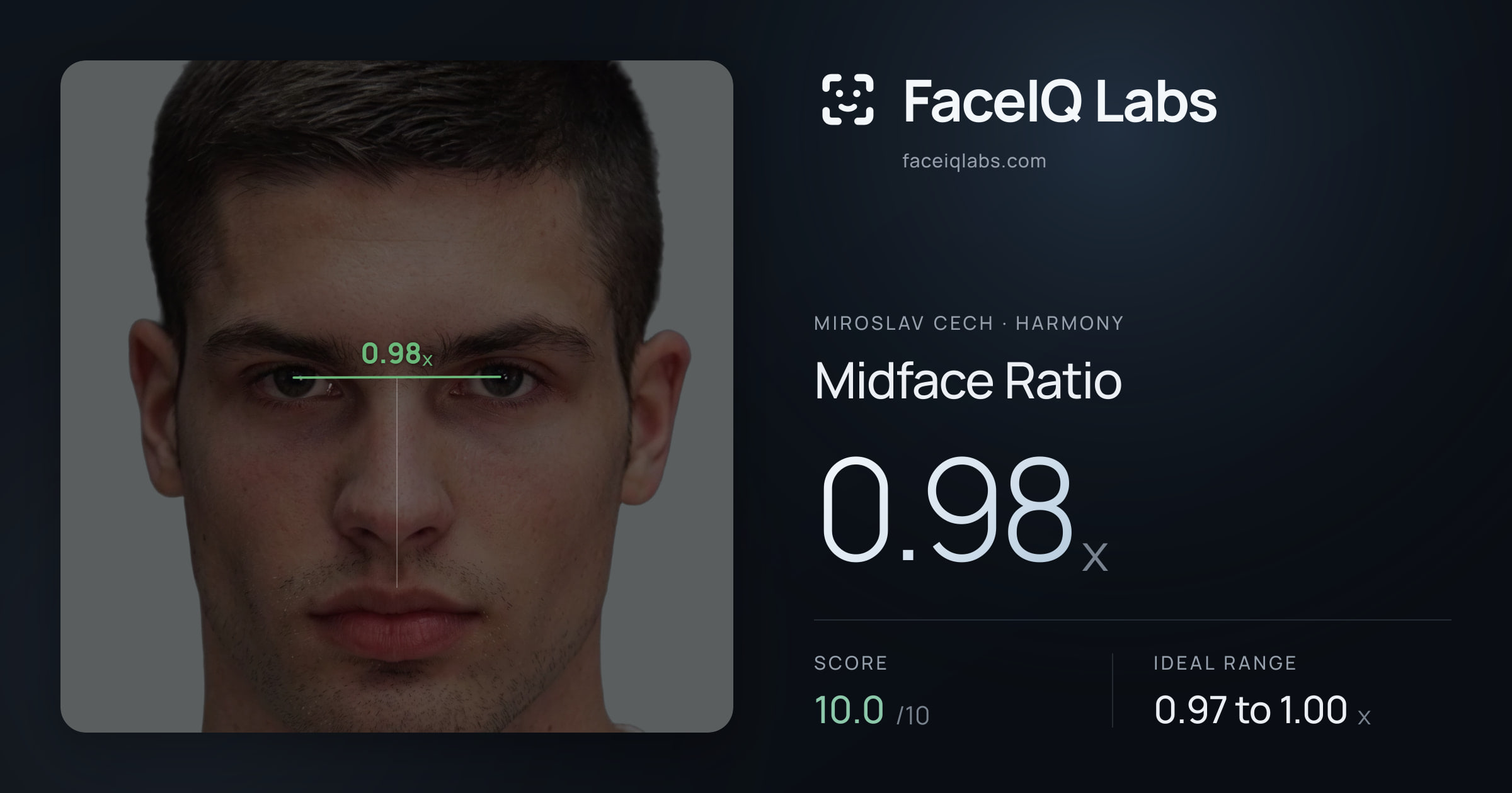 Miroslav Cech Midface Ratio: 0.98x, drawn on the photo