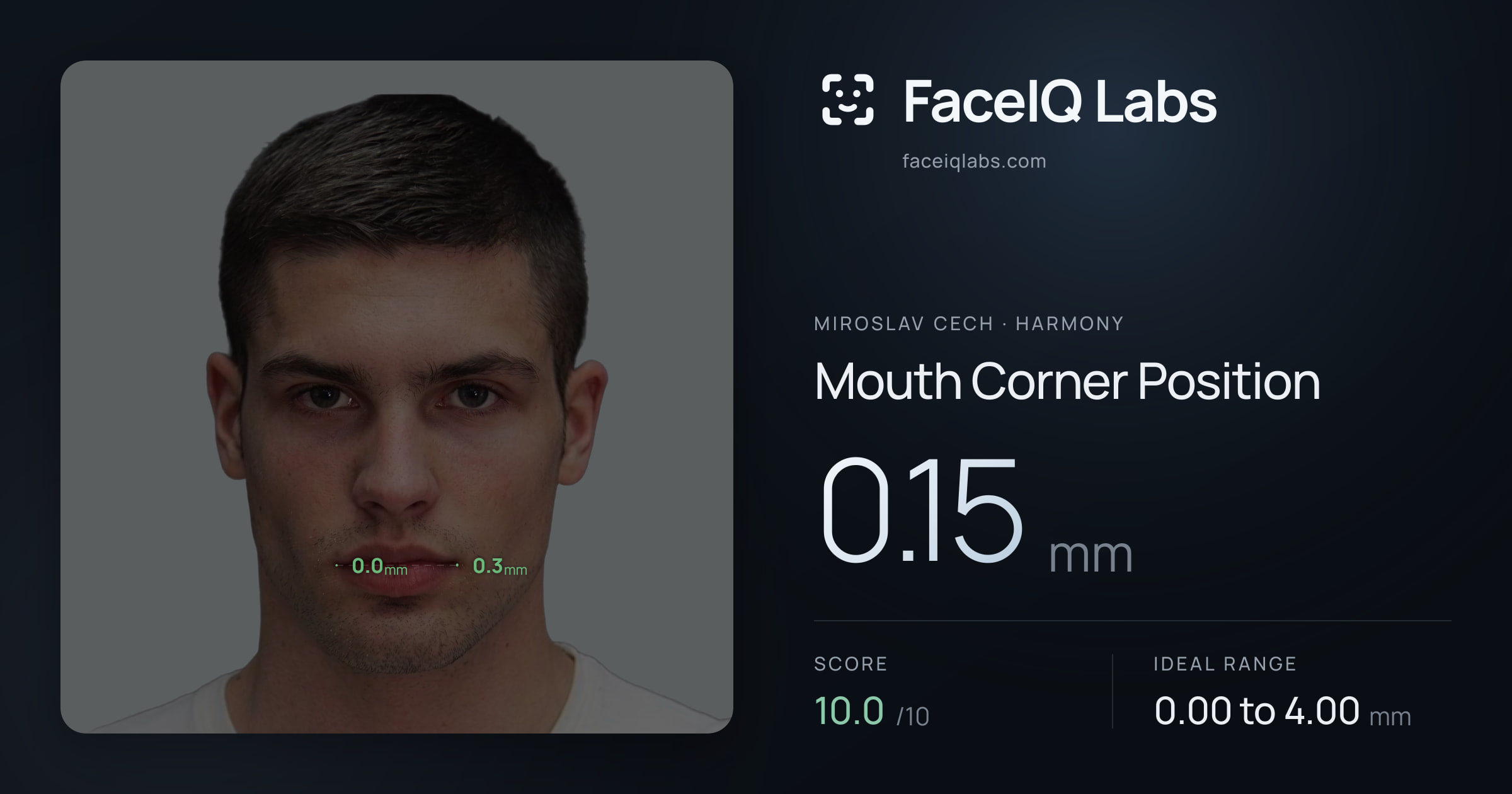 Miroslav Cech Mouth Corner Position: 0.15mm, drawn on the photo