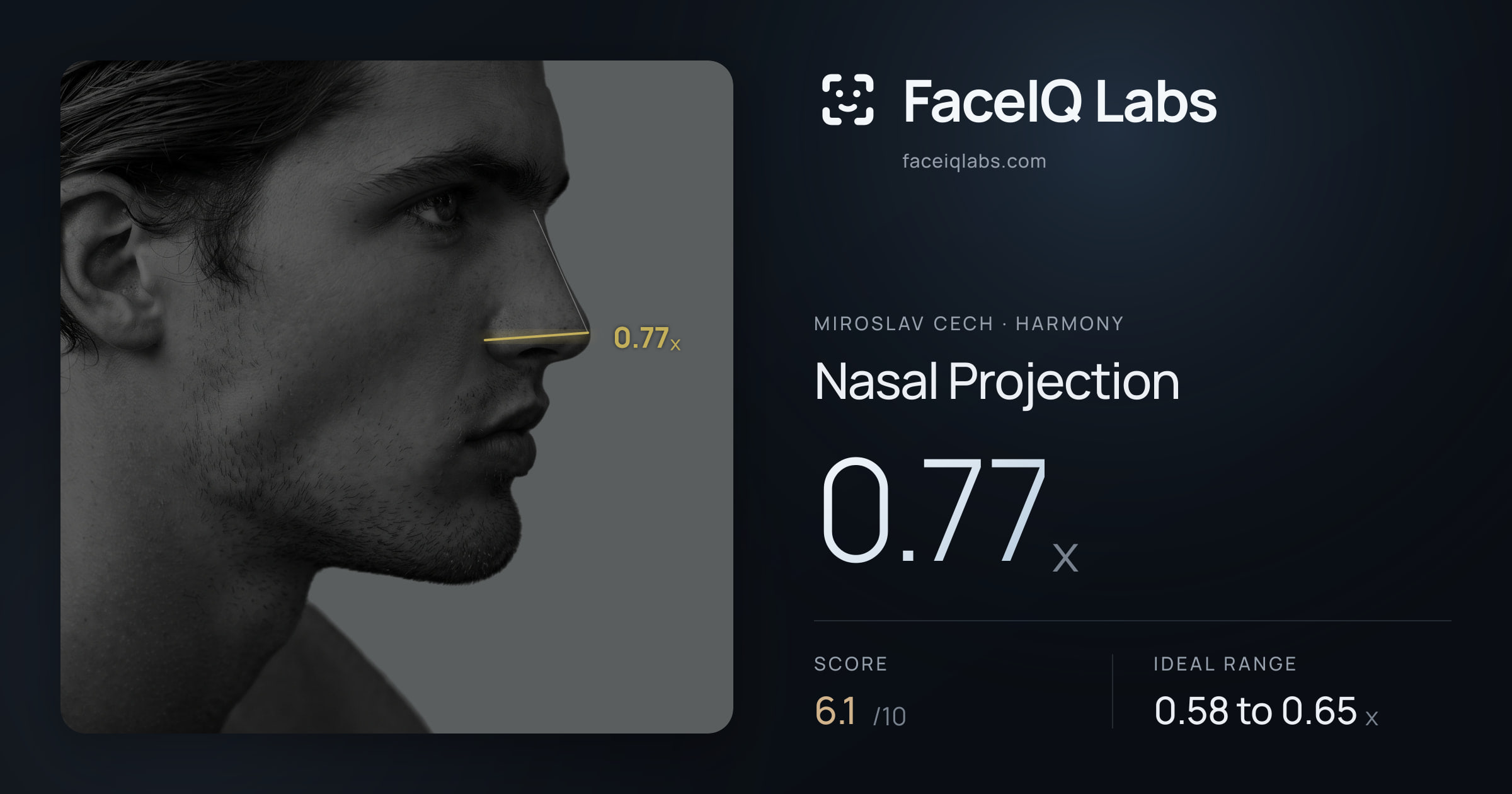 Miroslav Cech Nasal Projection: 0.77x, drawn on the photo
