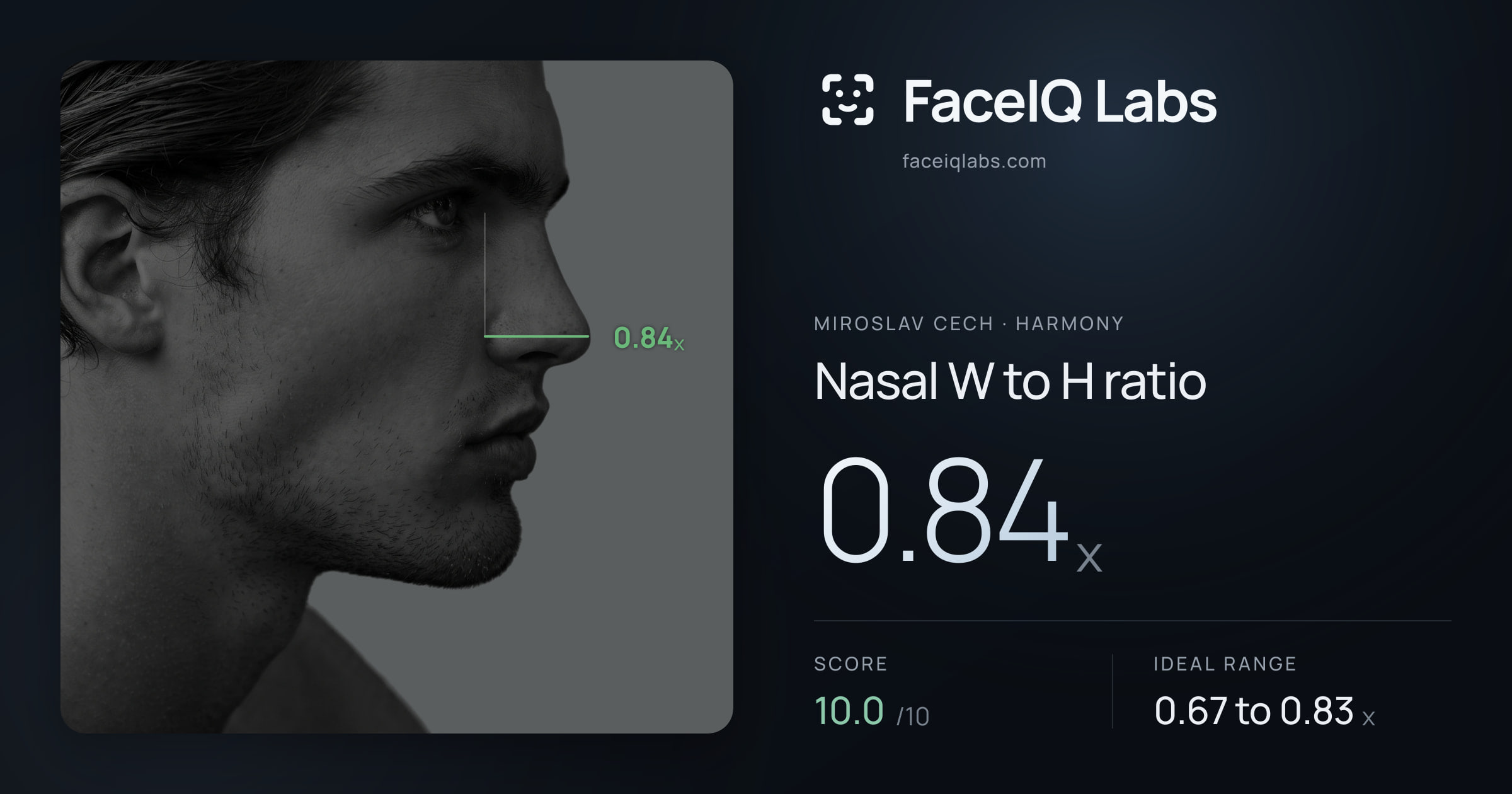 Miroslav Cech Nasal W to H ratio: 0.84x, drawn on the photo