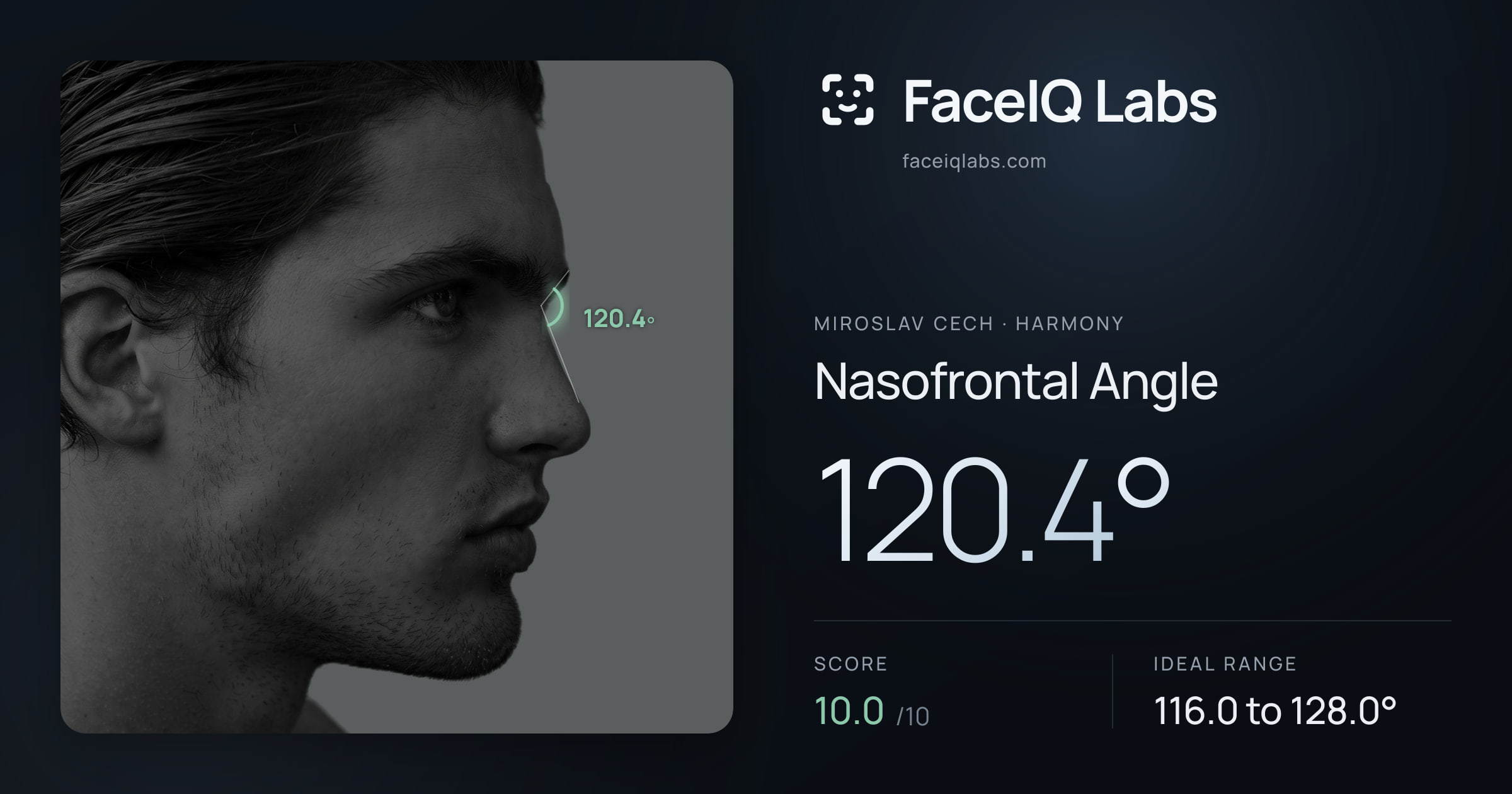 Miroslav Cech Nasofrontal Angle: 120.4°, drawn on the photo