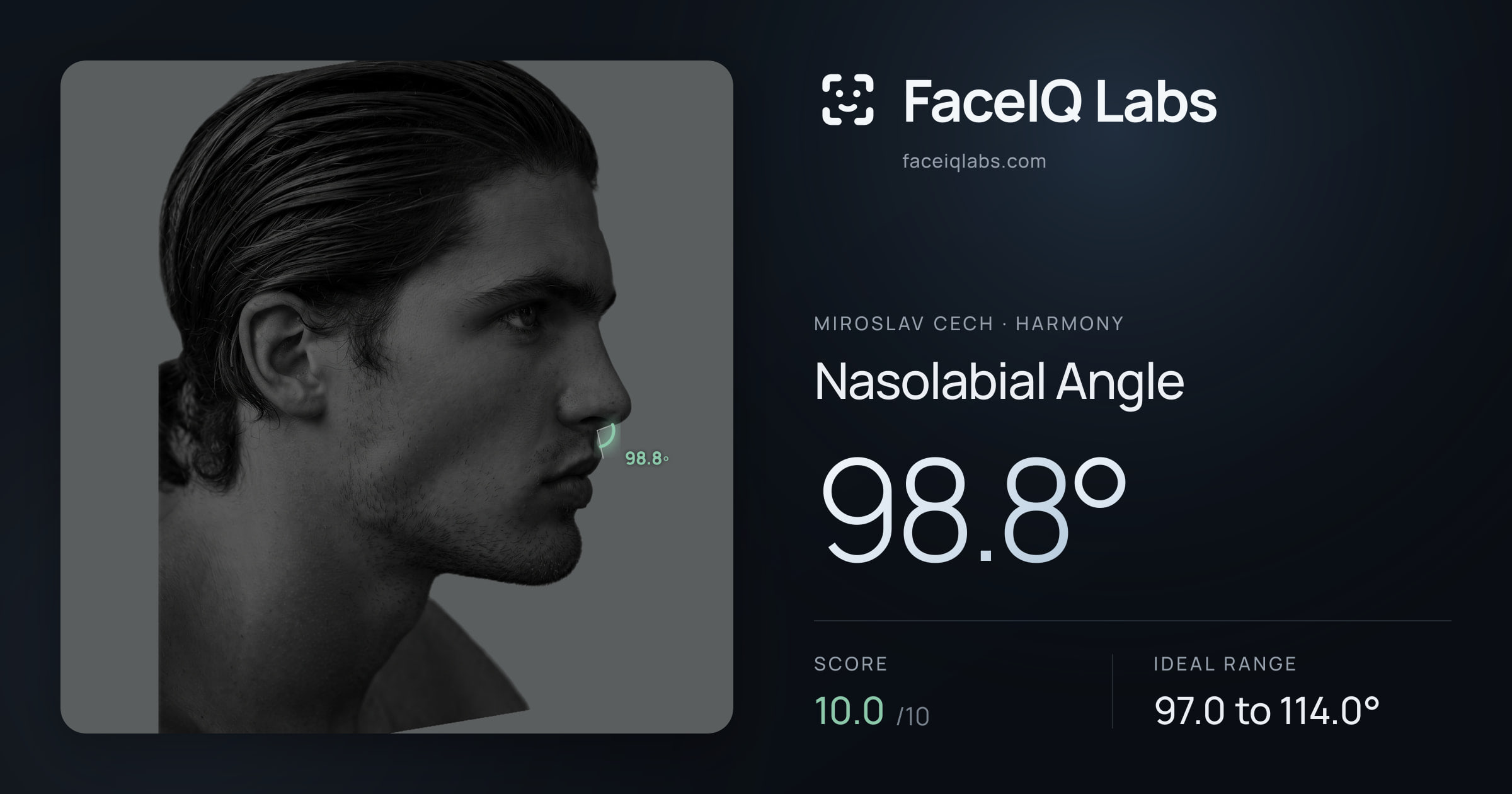Miroslav Cech Nasolabial Angle: 98.8°, drawn on the photo