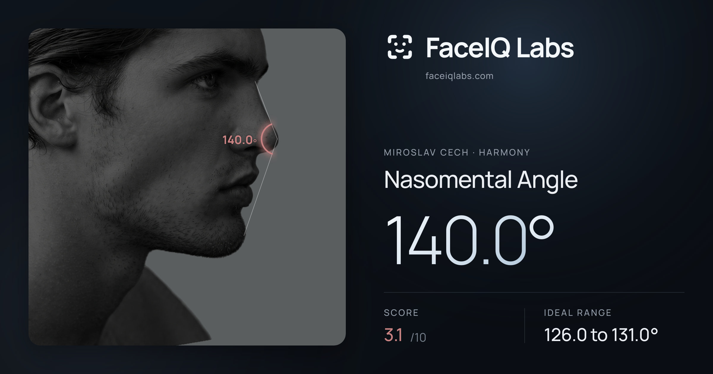 Miroslav Cech Nasomental Angle: 140.0°, drawn on the photo