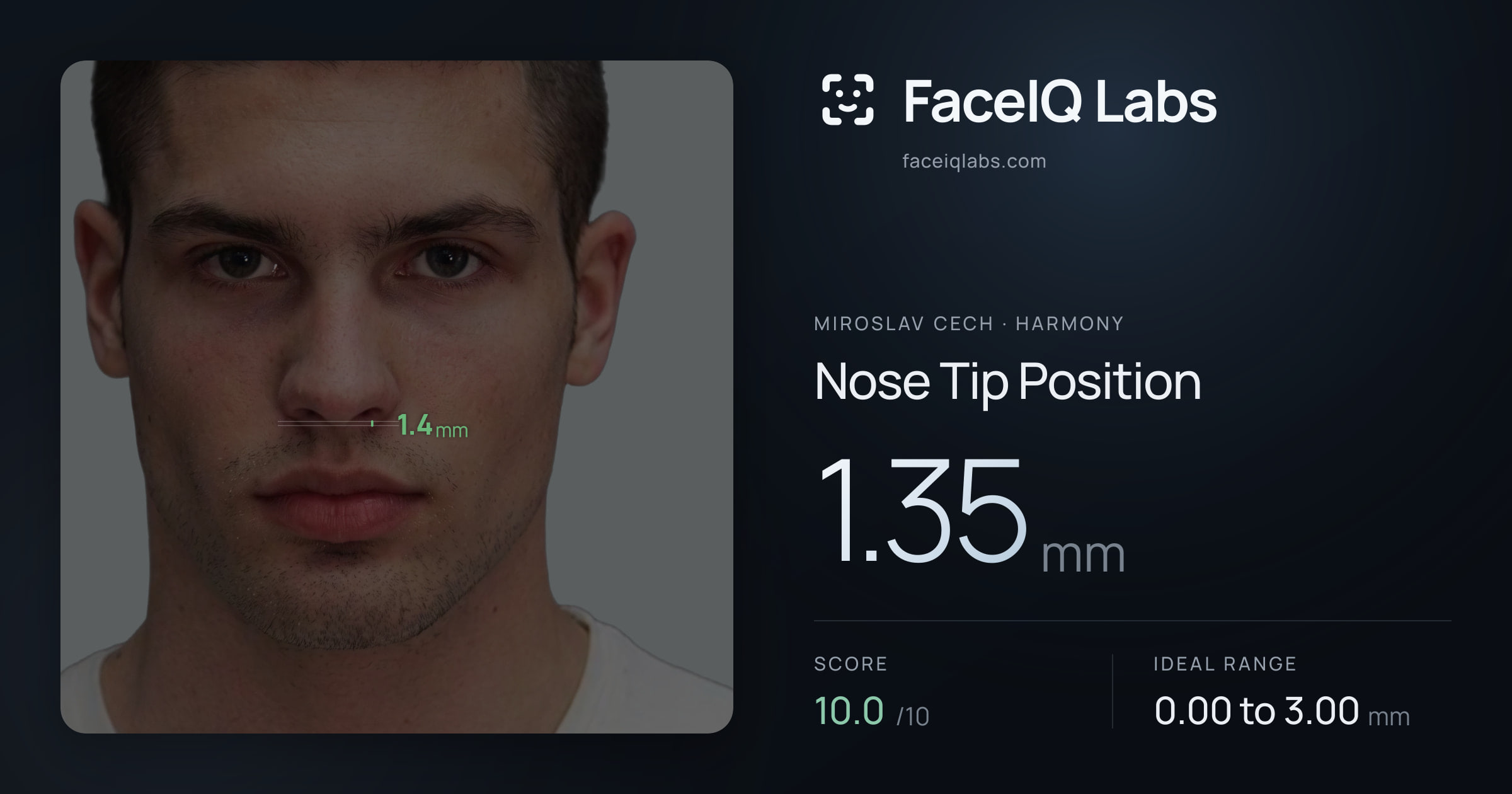 Miroslav Cech Nose Tip Position: 1.35mm, drawn on the photo