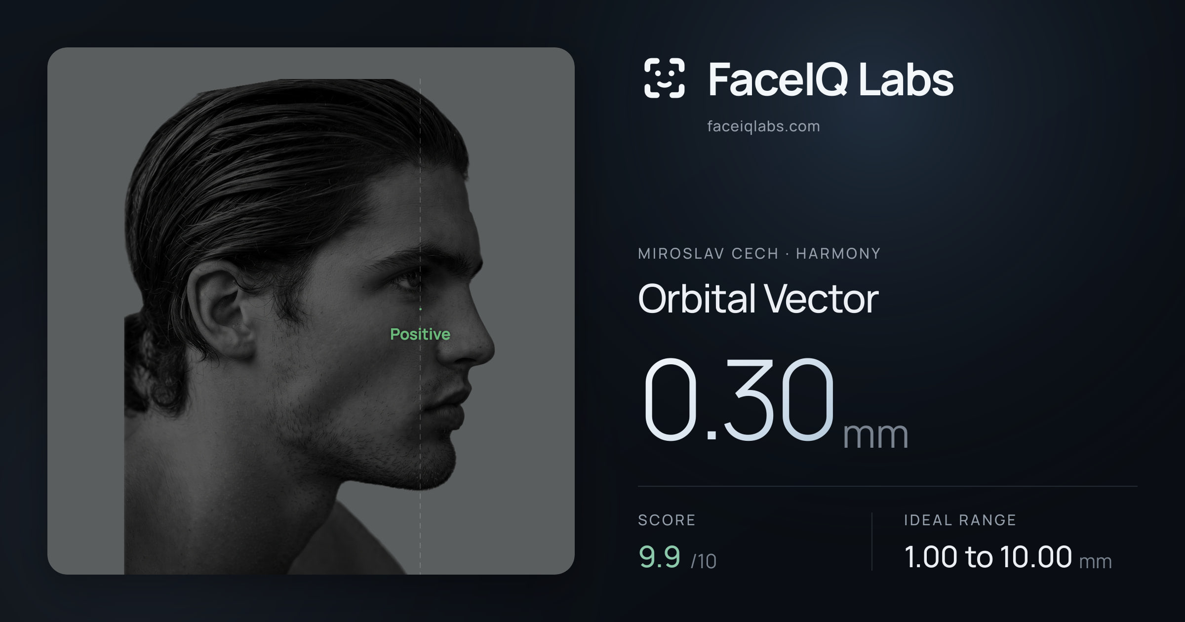 Miroslav Cech Orbital Vector: 0.30mm, drawn on the photo