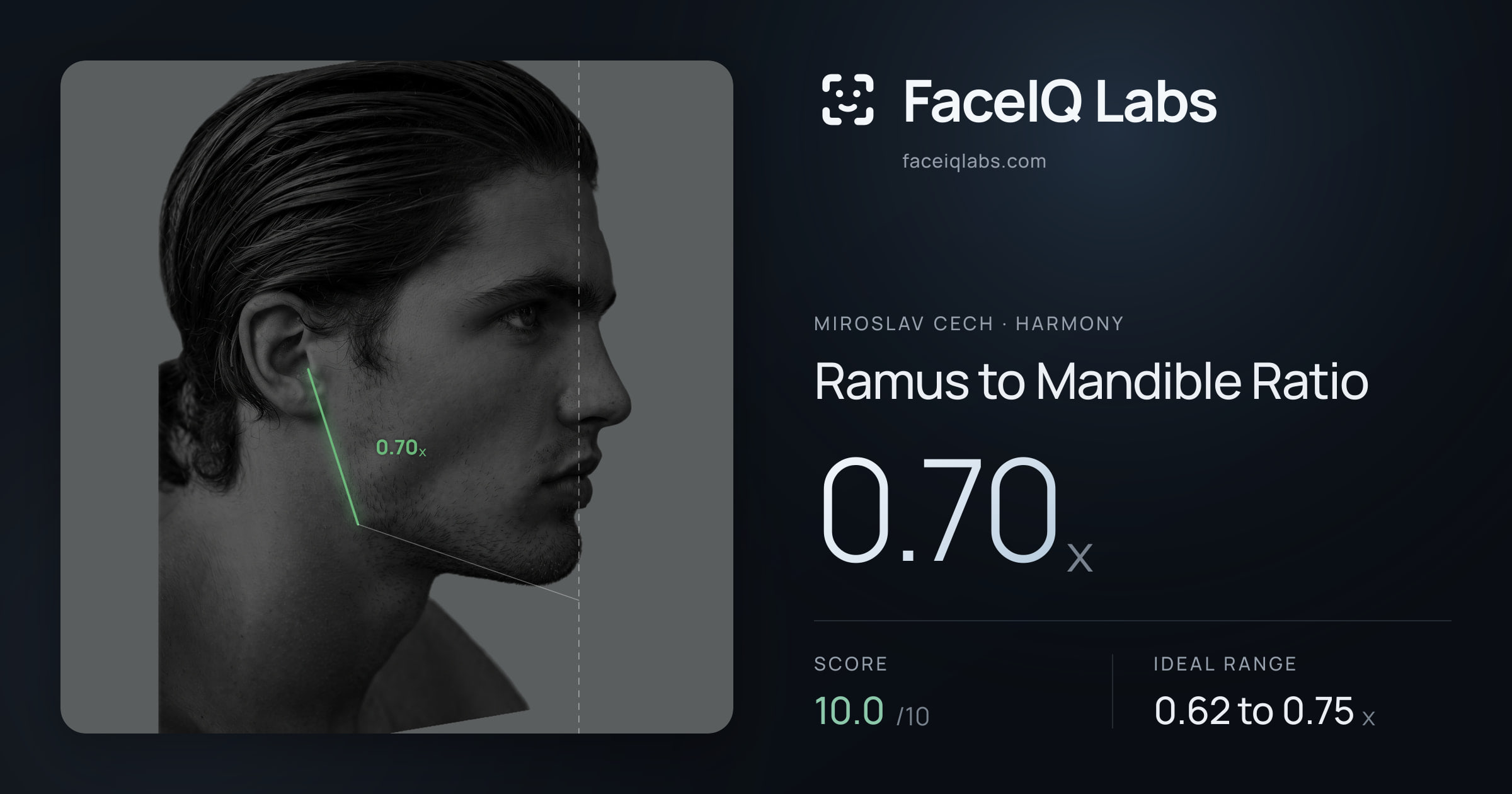 Miroslav Cech Ramus to Mandible Ratio: 0.70x, drawn on the photo