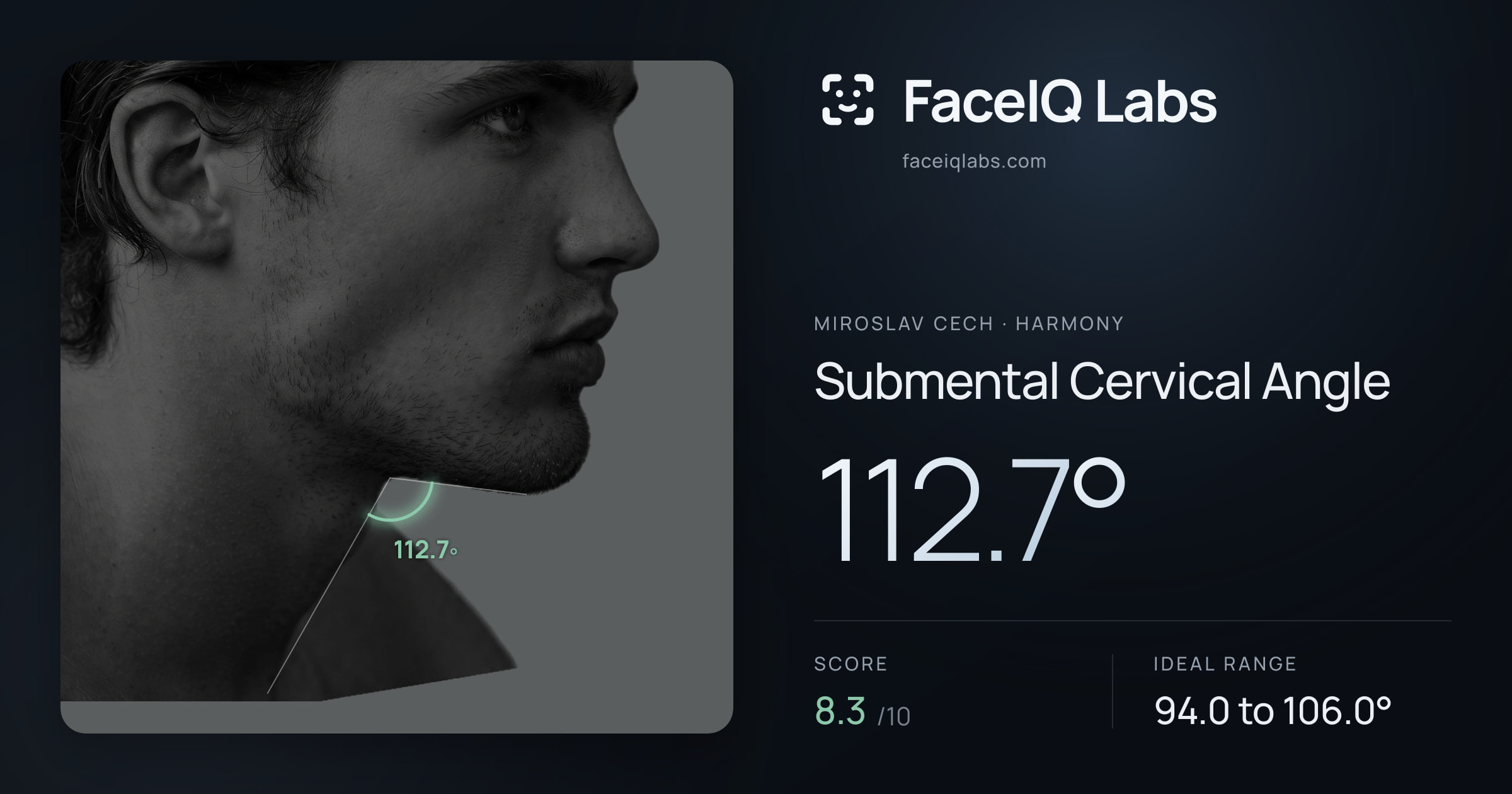Miroslav Cech Submental Cervical Angle: 112.7°, drawn on the photo