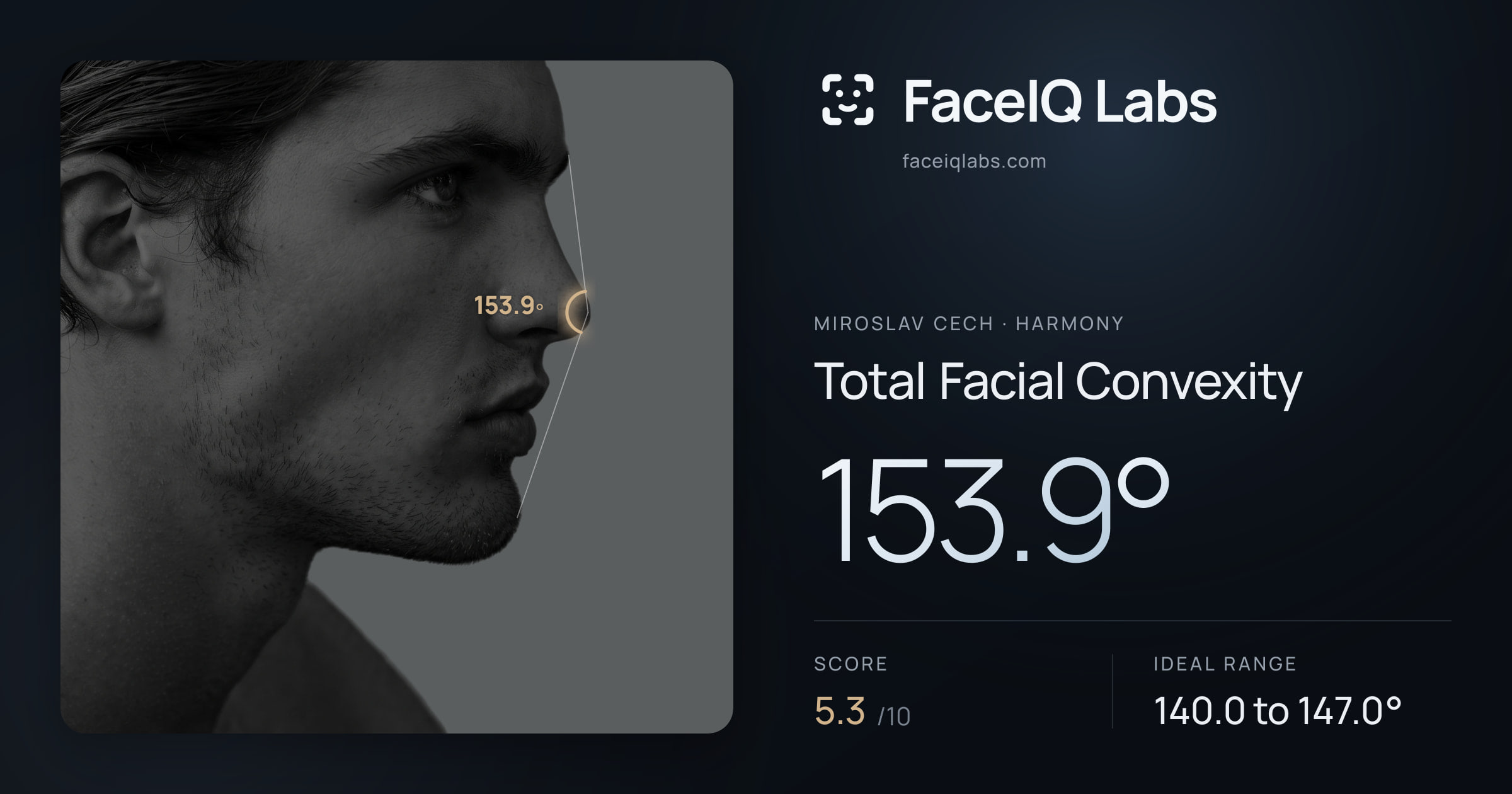 Miroslav Cech Total Facial Convexity: 153.9°, drawn on the photo