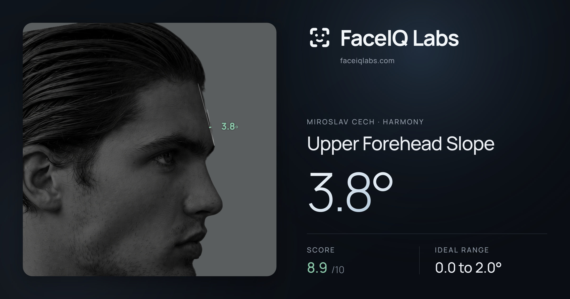 Miroslav Cech Upper Forehead Slope: 3.8°, drawn on the photo