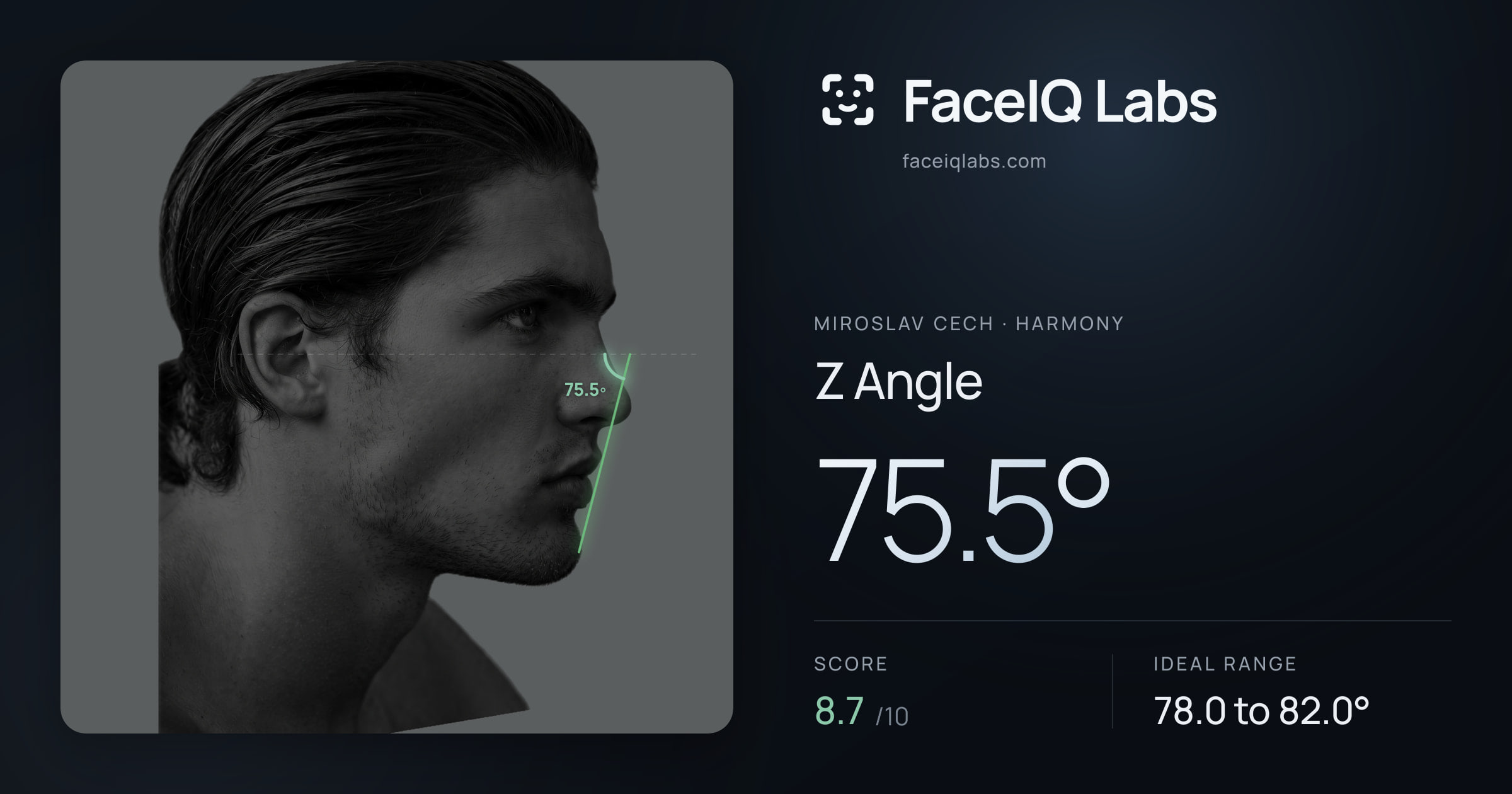Miroslav Cech Z Angle: 75.5°, drawn on the photo