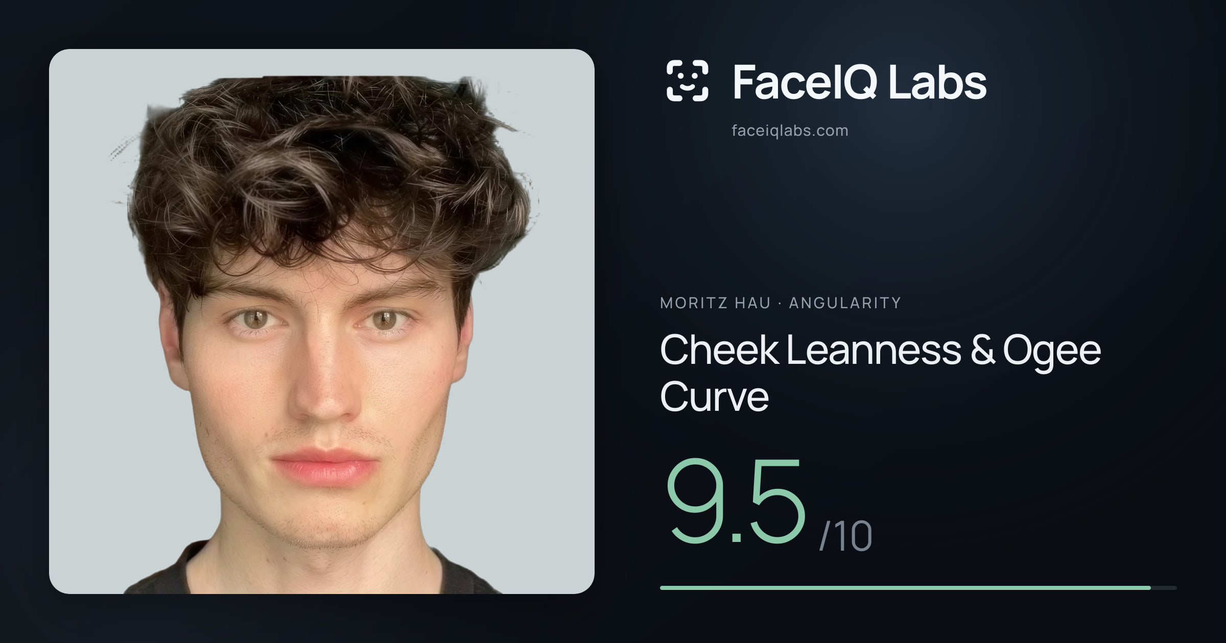Moritz Hau Cheek Leanness & Ogee Curve: 9.5/10, drawn on the photo