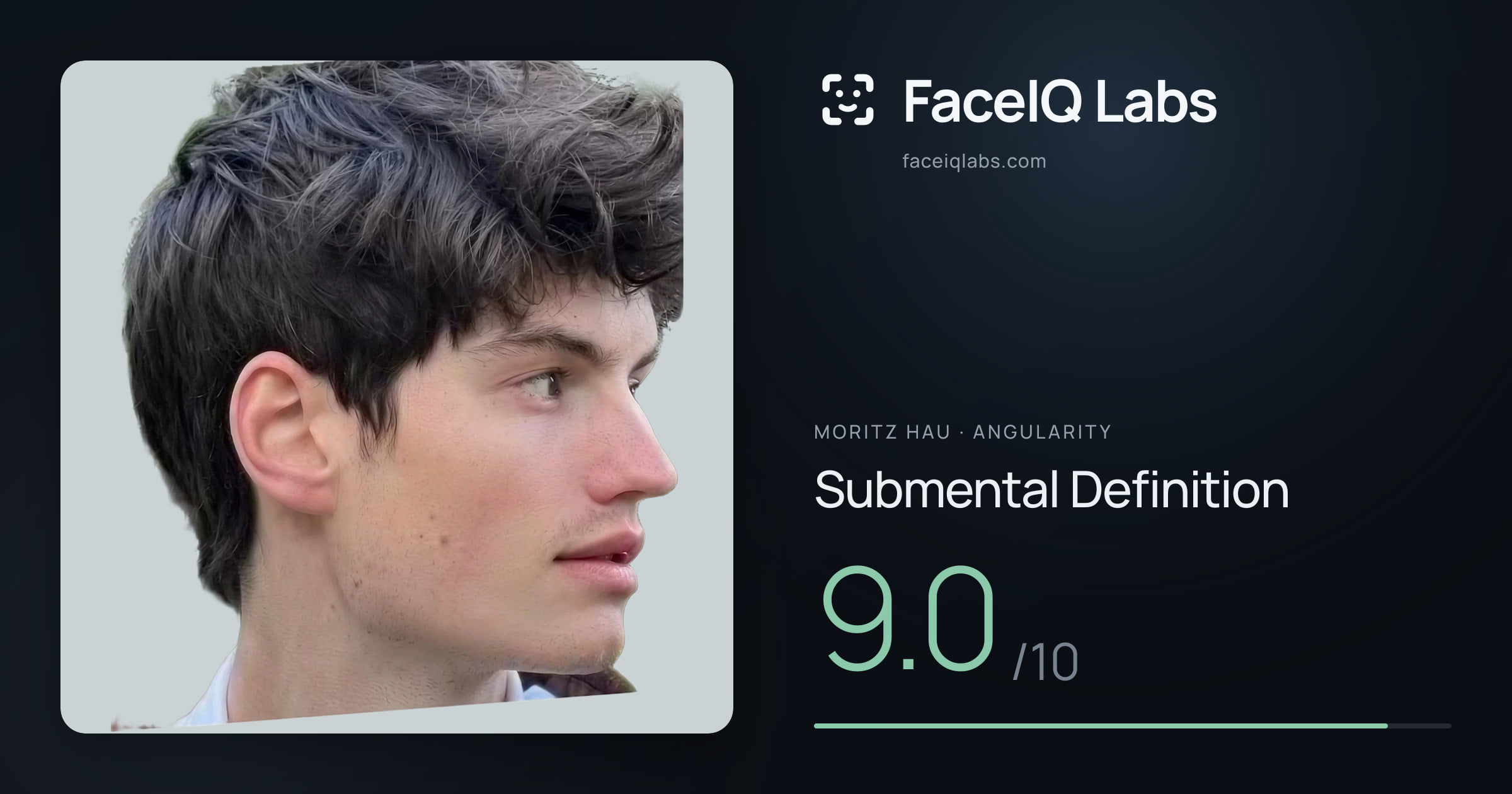 Moritz Hau Submental Definition: 9.0/10, drawn on the photo