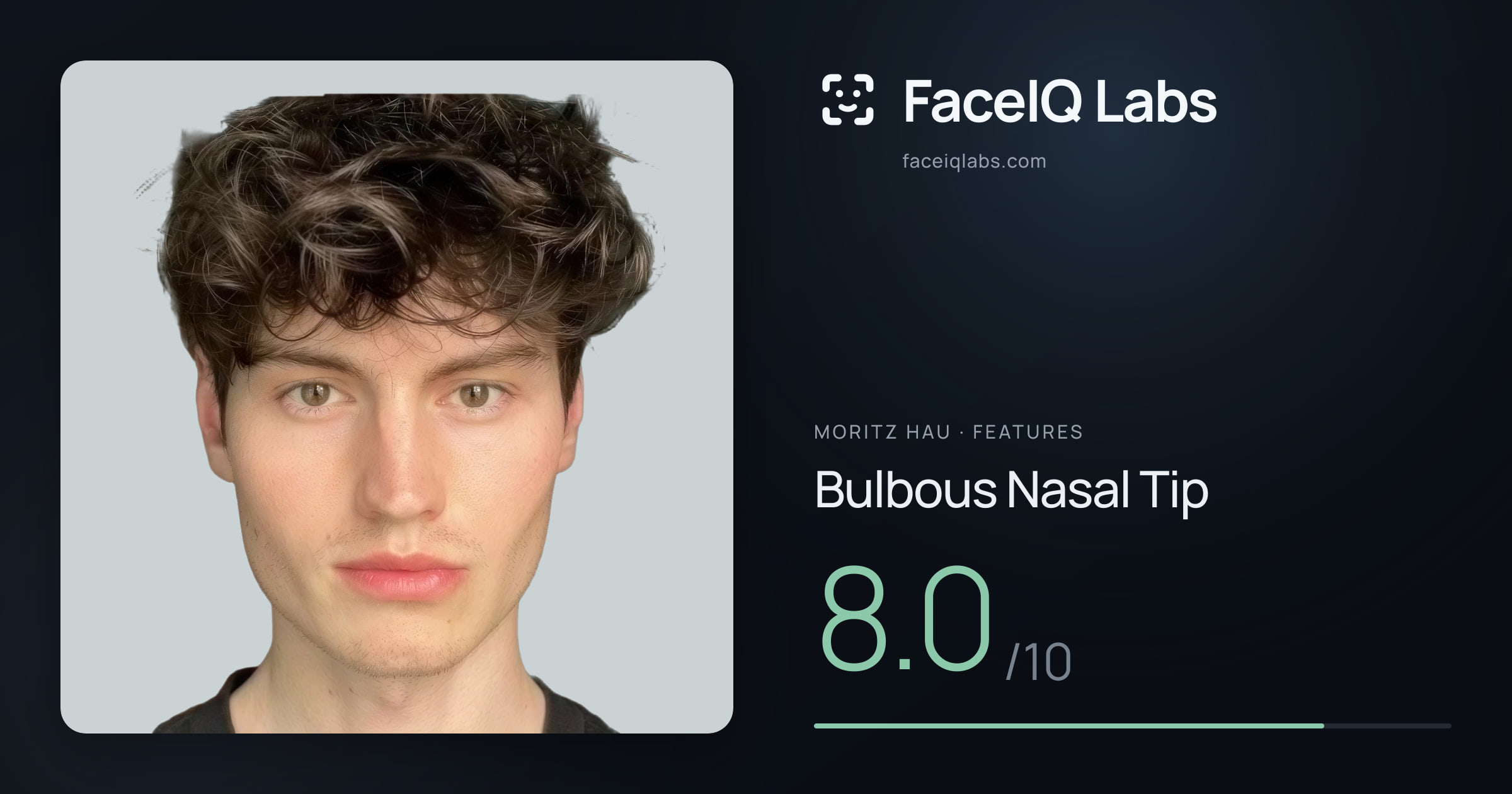 Moritz Hau Bulbous Nasal Tip: 8.0/10, drawn on the photo