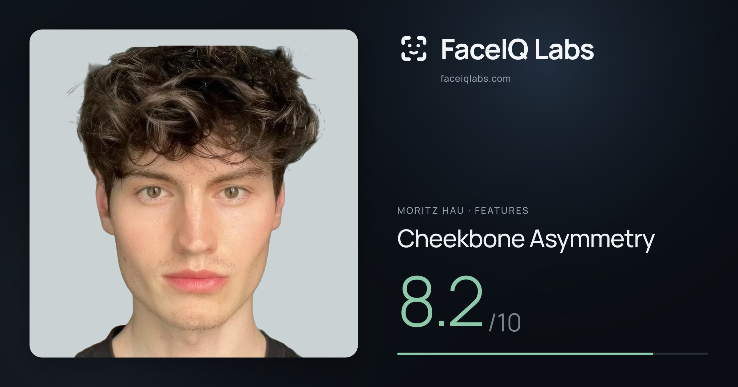 Moritz Hau Cheekbone Asymmetry: 8.2/10, drawn on the photo