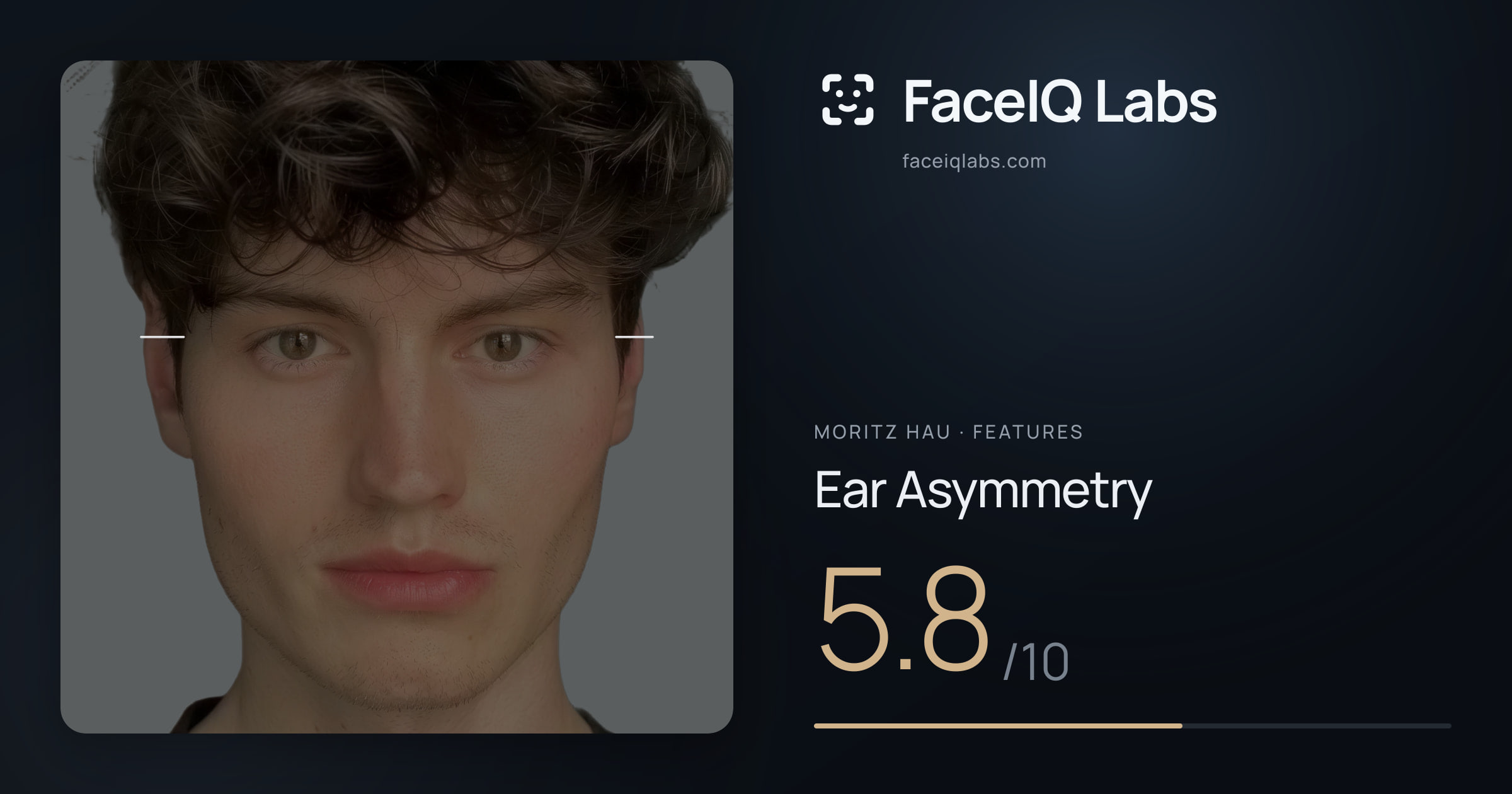 Moritz Hau Ear Asymmetry: 5.8/10, drawn on the photo