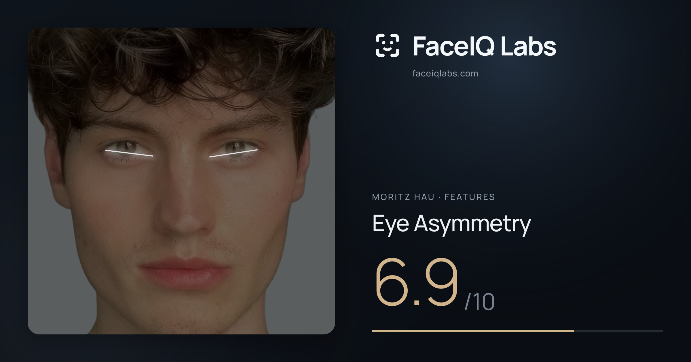 Moritz Hau Eye Asymmetry: 6.9/10, drawn on the photo