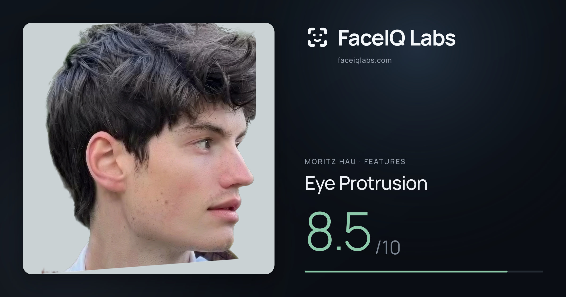 Moritz Hau Eye Protrusion: 8.5/10, drawn on the photo
