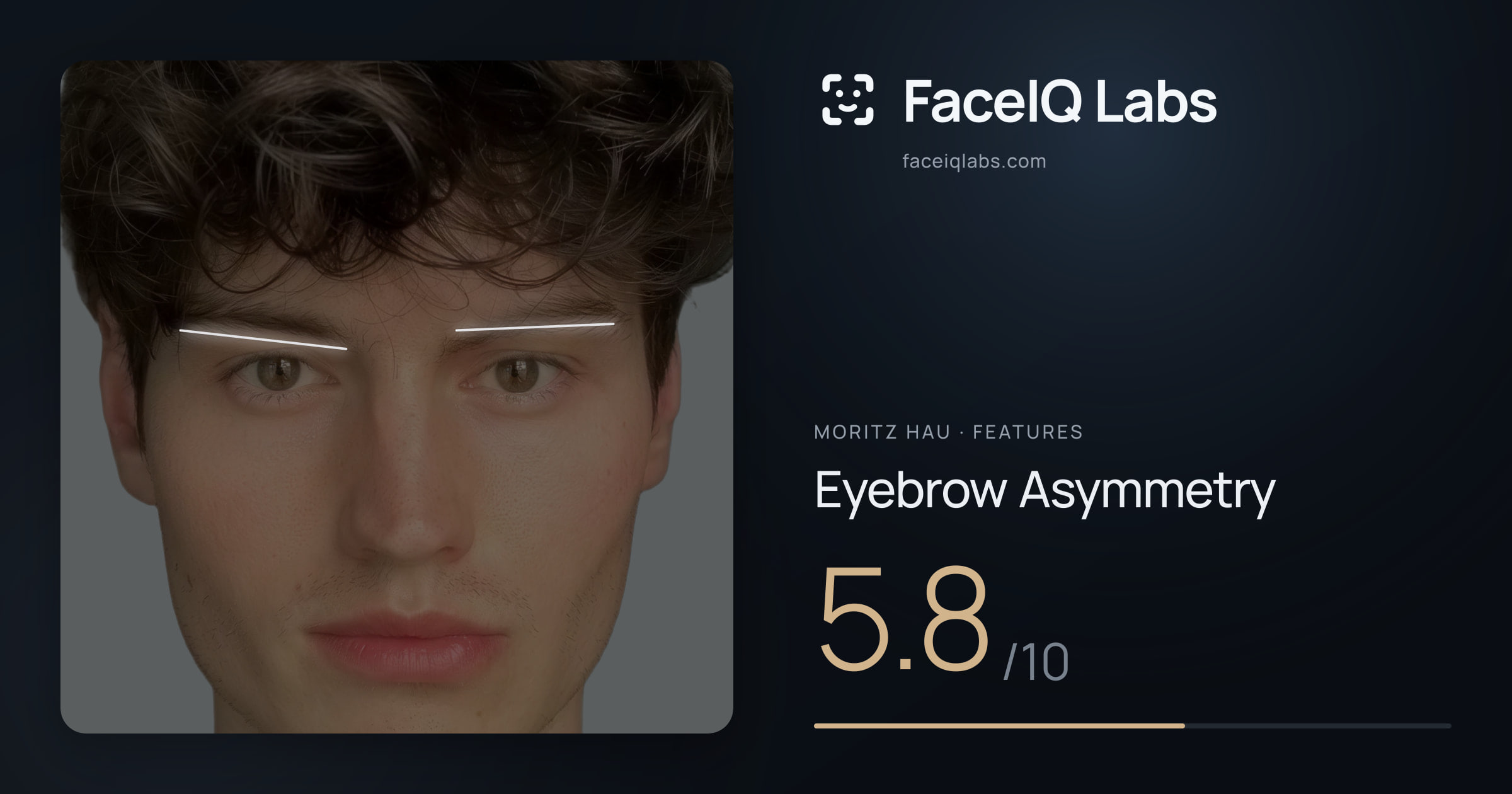 Moritz Hau Eyebrow Asymmetry: 5.8/10, drawn on the photo