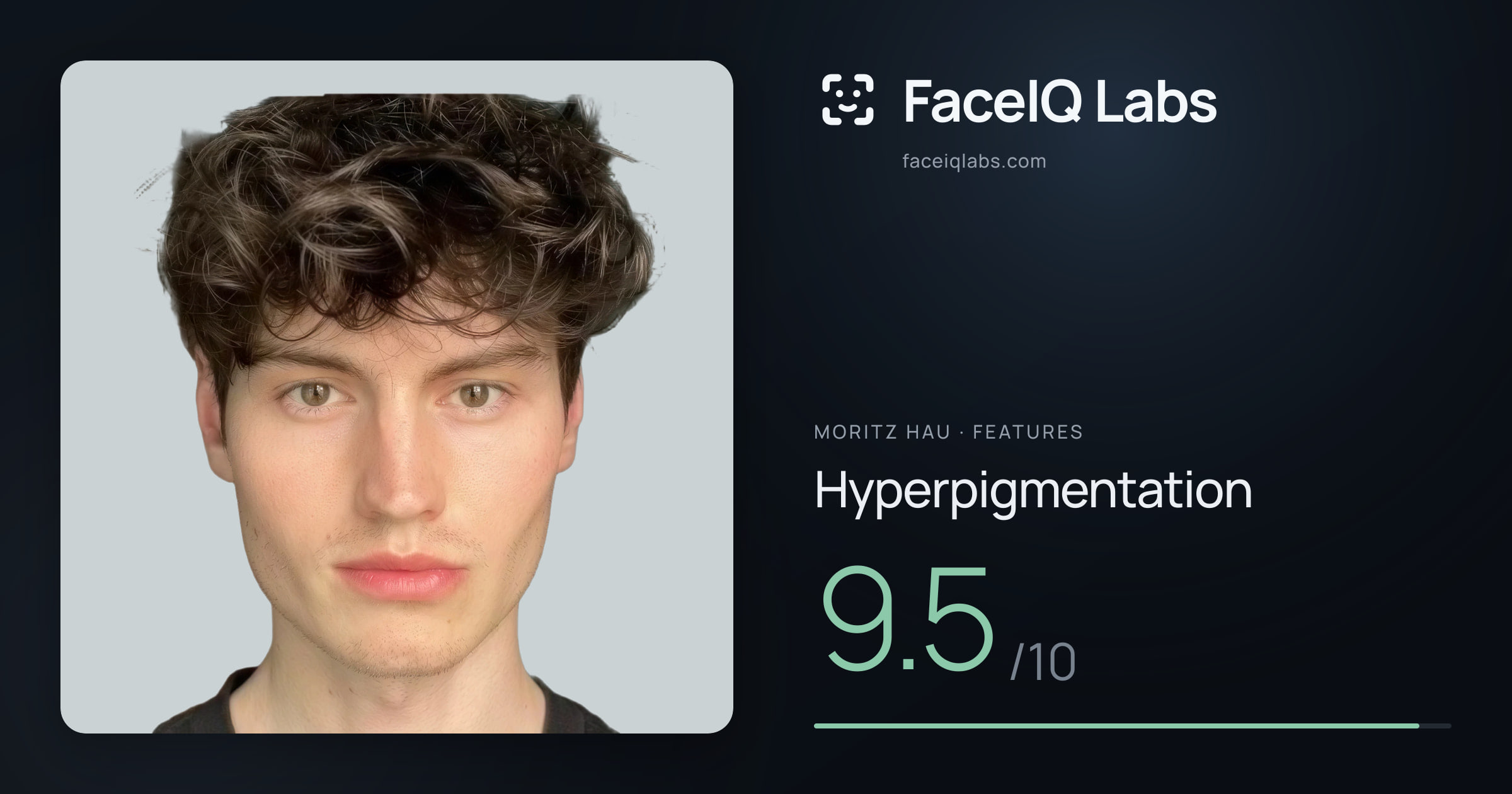 Moritz Hau Hyperpigmentation: 9.5/10, drawn on the photo