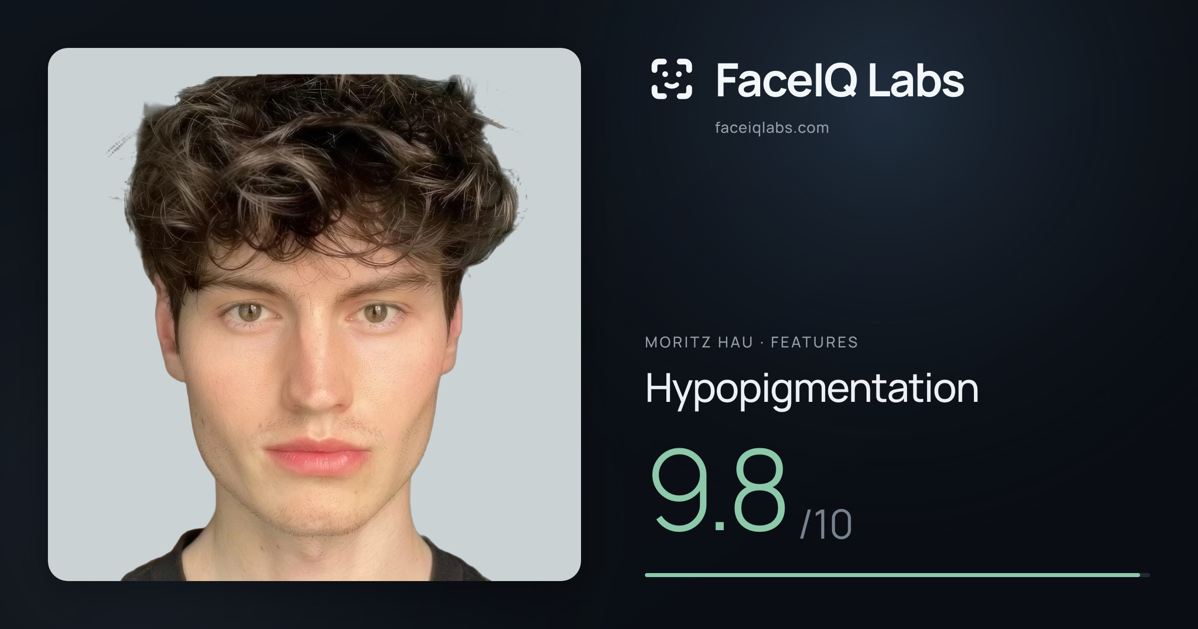 Moritz Hau Hypopigmentation: 9.8/10, drawn on the photo