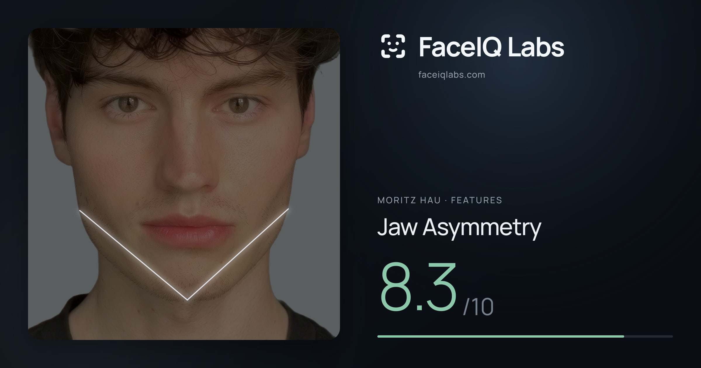 Moritz Hau Jaw Asymmetry: 8.3/10, drawn on the photo