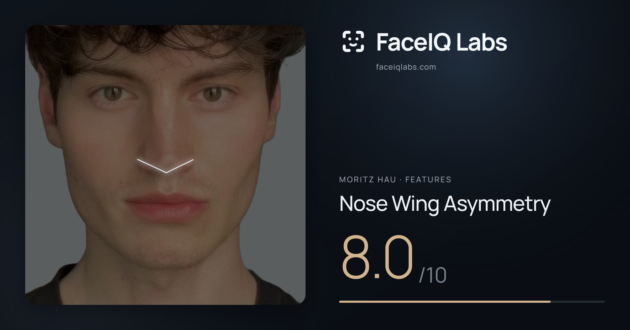 Moritz Hau Nose Wing Asymmetry: 8.0/10, drawn on the photo