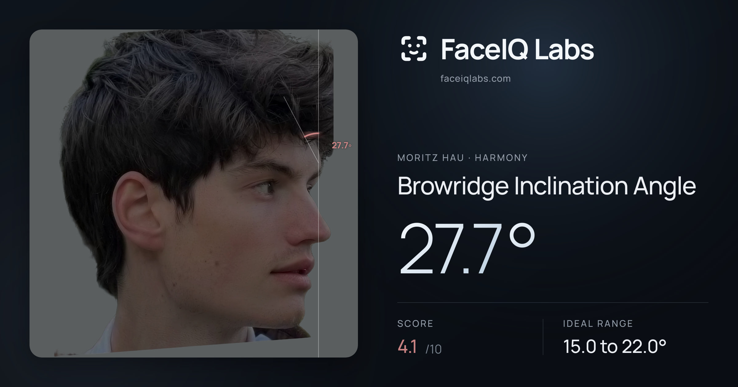 Moritz Hau Browridge Inclination Angle: 27.7°, drawn on the photo