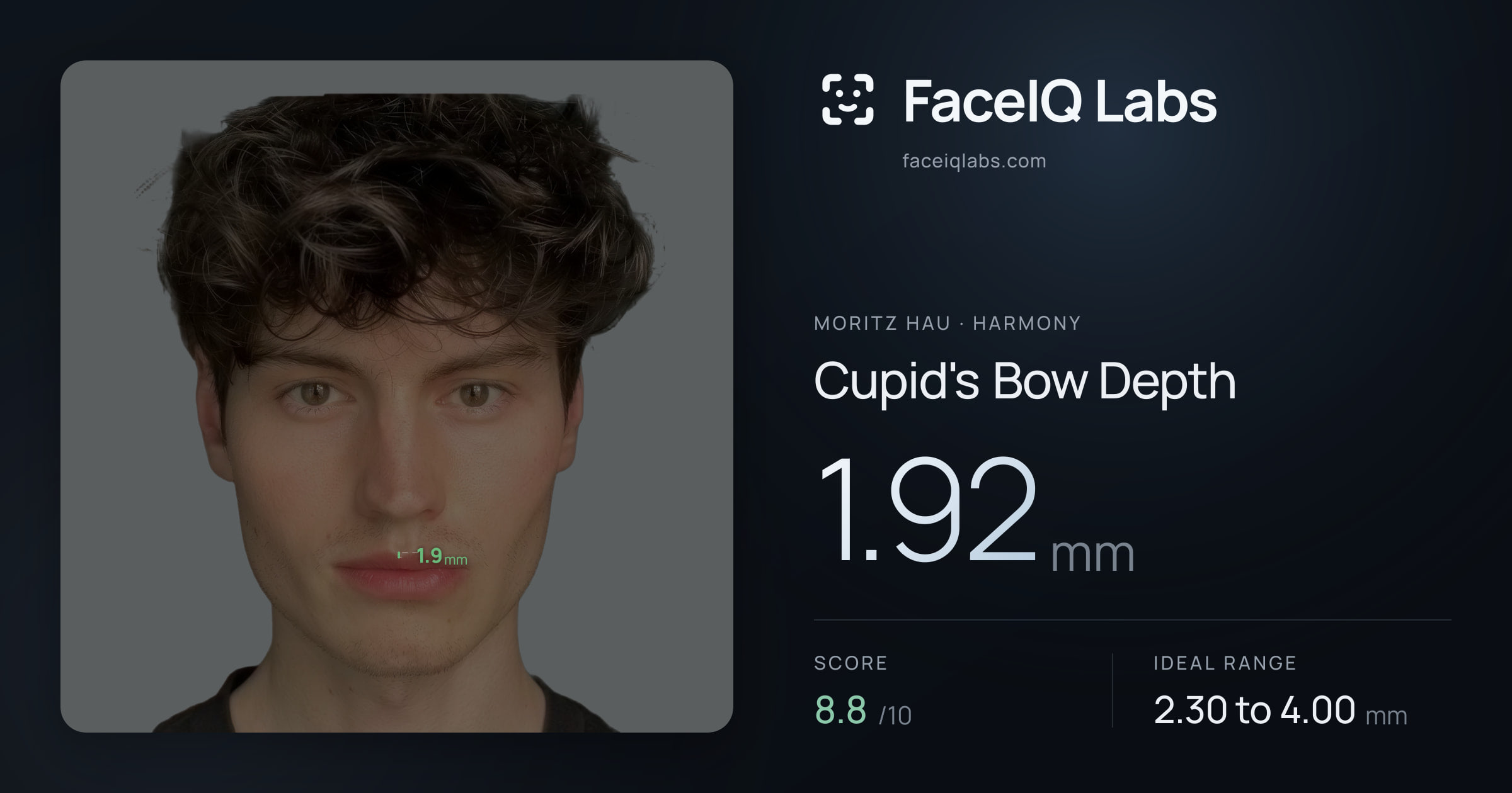Moritz Hau Cupid's Bow Depth: 1.92mm, drawn on the photo
