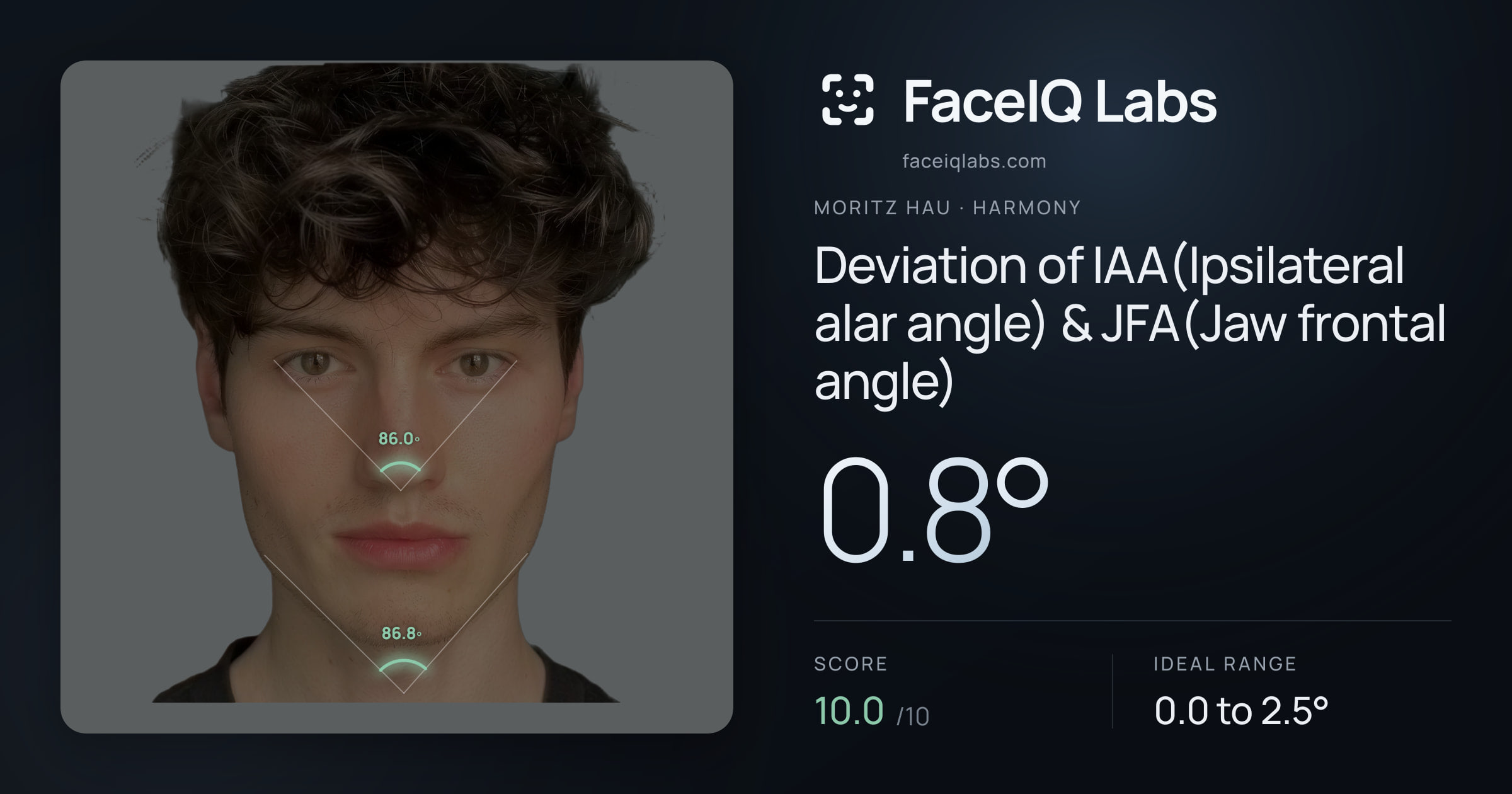 Moritz Hau Deviation of IAA(Ipsilateral alar angle) & JFA(Jaw frontal angle): 0.8°, drawn on the photo
