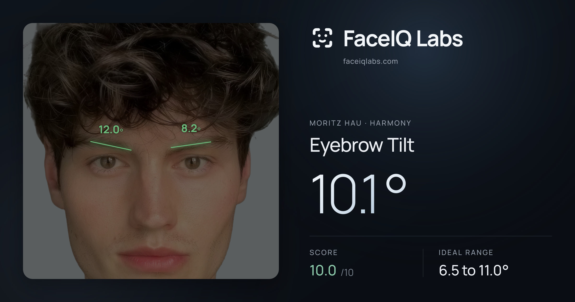 Moritz Hau Eyebrow Tilt: 10.1°, drawn on the photo